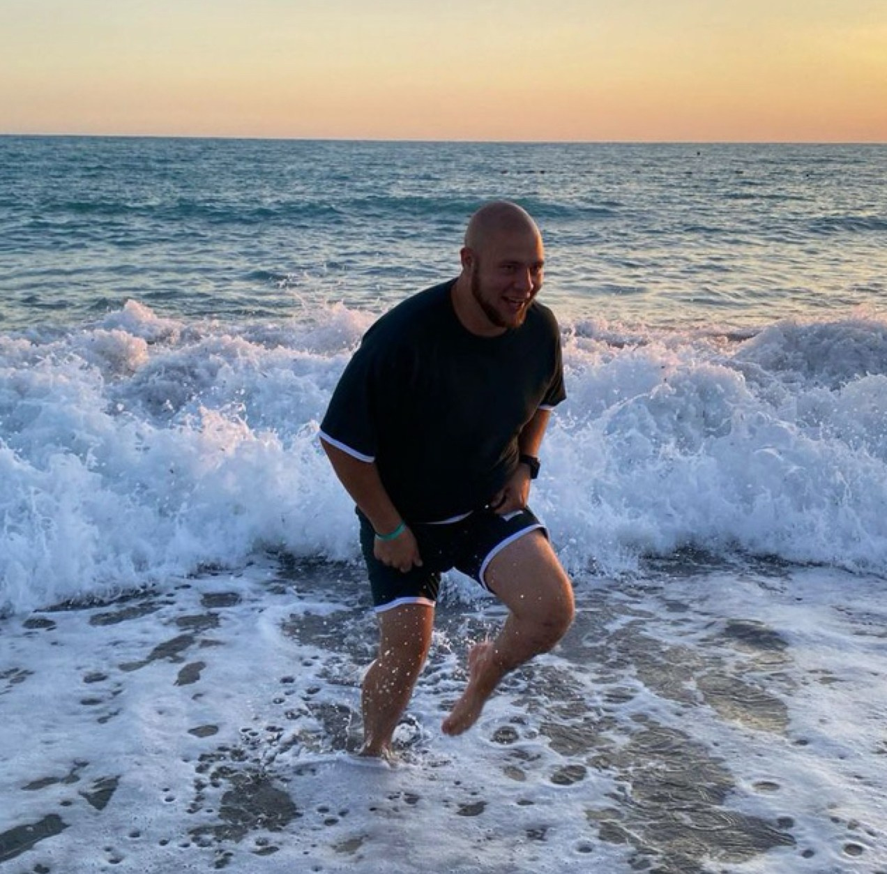 Нажмите на фото что бы открыть. SMP Трихопигментация Воронеж Волгоград Москва Казань Никита Нестеров