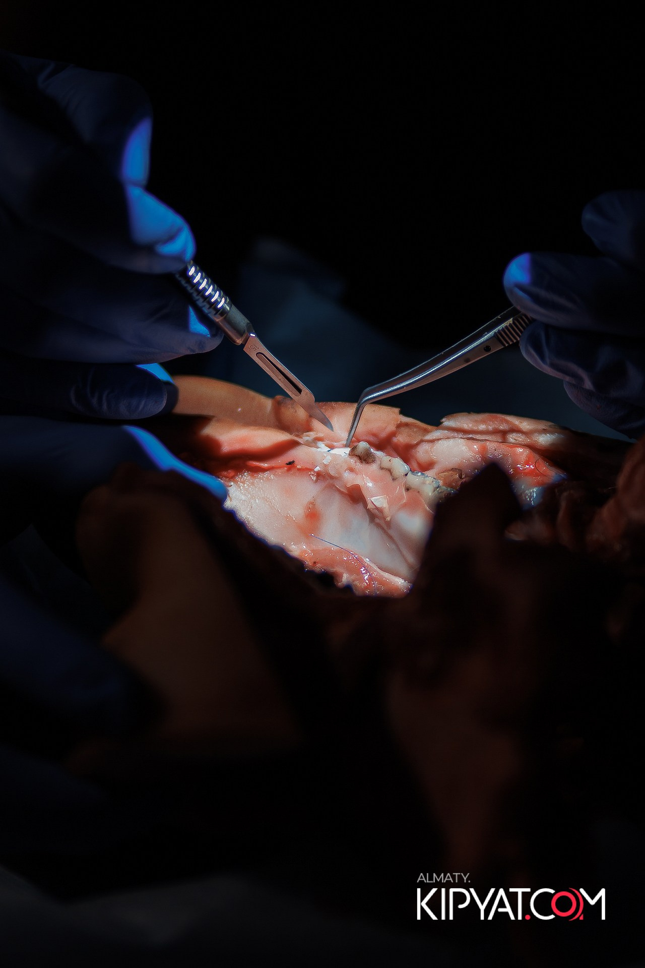 КУРС СТОМАТОЛОГОВ «НКР И ПОСЛЕДУЮЩАЯ РАБОТА С МЯГКИМИ ТКАНЯМИ». КИПЯТКОМ АЛМАТЫ!