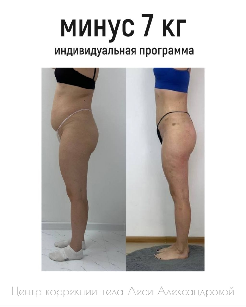 Результаты. Центр Коррекции Тела в городе Чехов