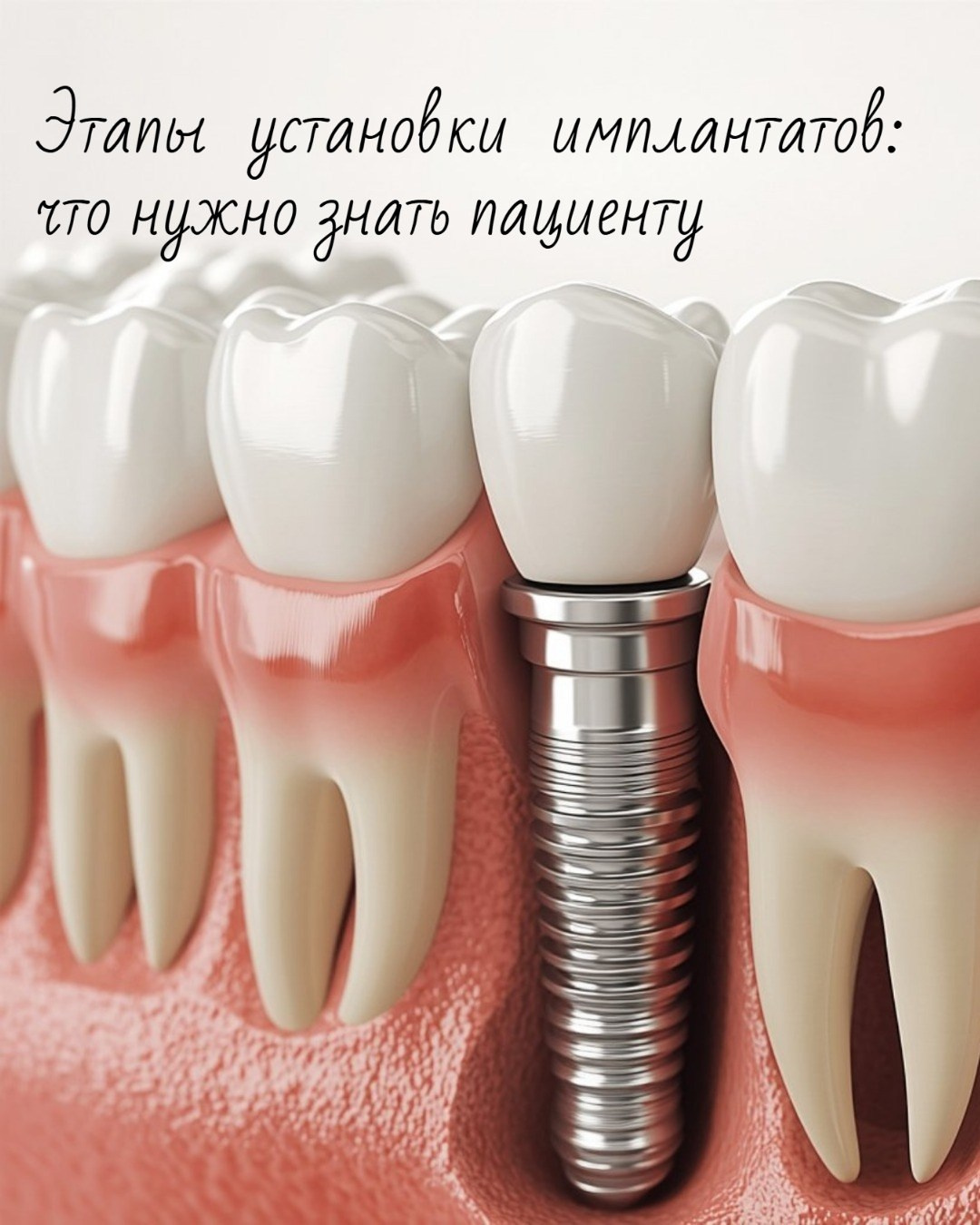 Пост-карусель для стоматологии. AI-дизайнер. Создание контента для онлайн форматов