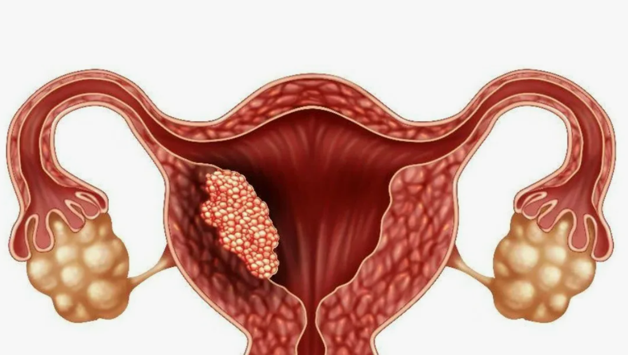 Готовые курсы приема продукции компании Сово-Сова. Сово-Сово — Омоложение и оздоровление!