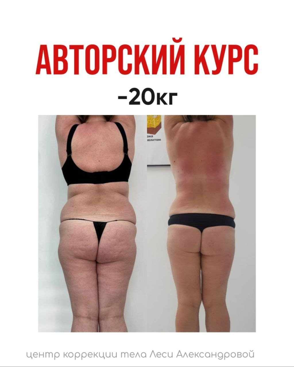 Результаты. Центр Коррекции Тела в городе Чехов