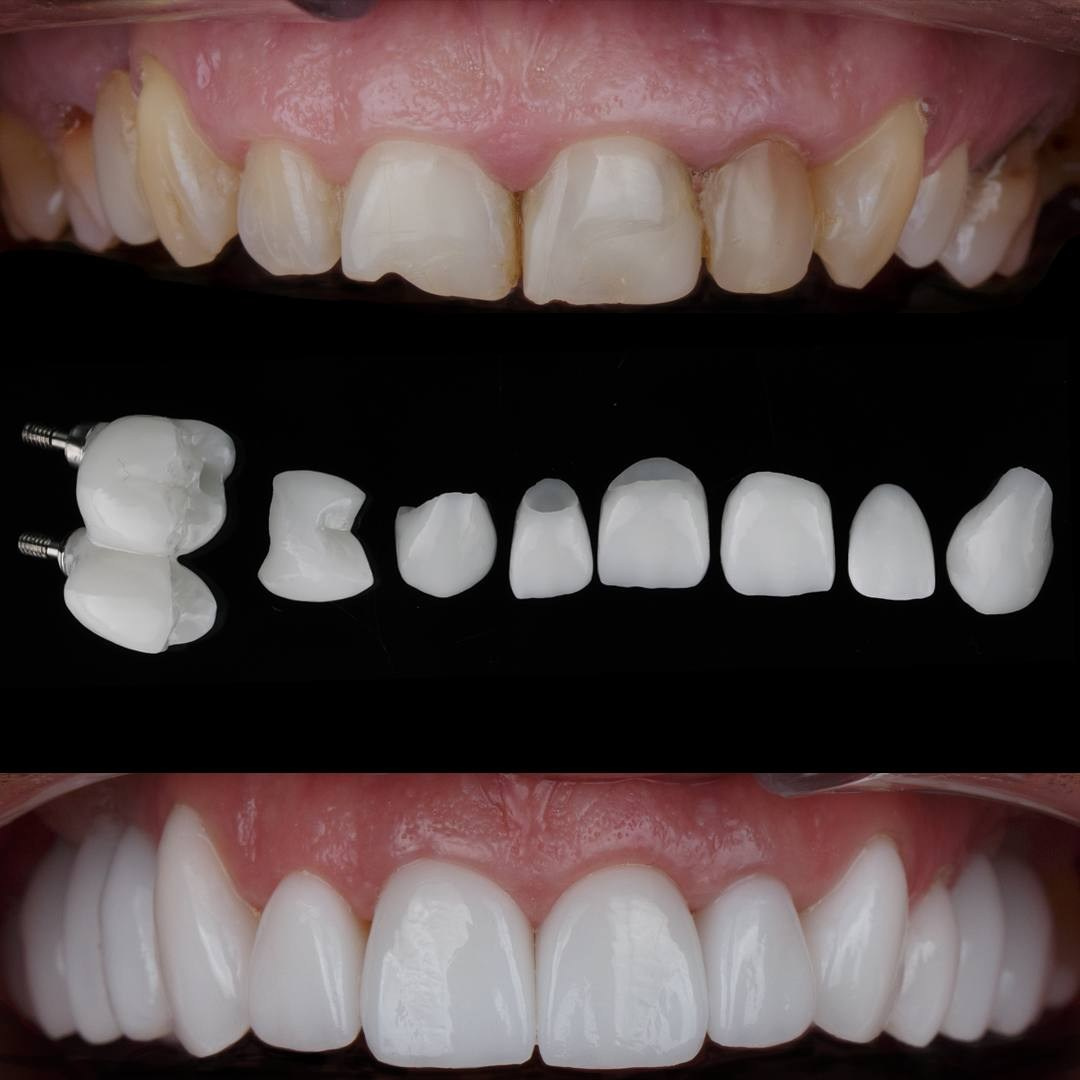 Ортопедия. Дентал фотограф — видеограф Денис Дорошенко