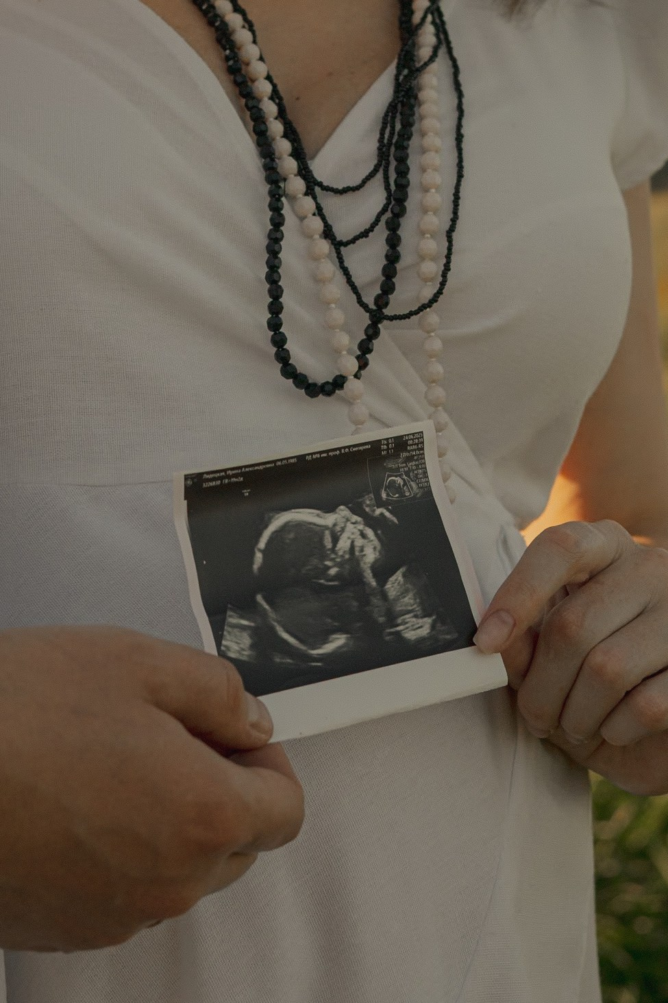 Володя и Ирина. Фотограф — анималист •love-story•|Санкт-Петербург