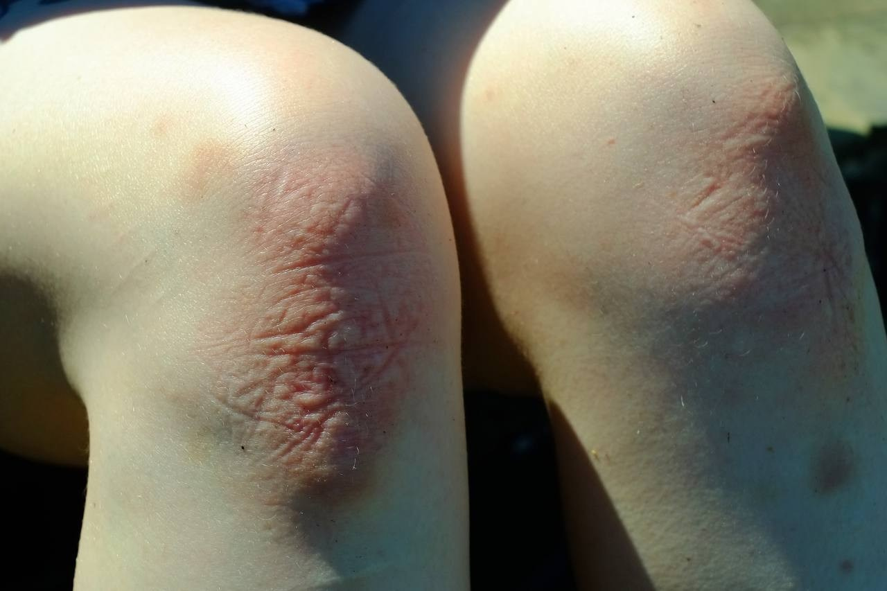 Skin. Софа Катастрофа, Одичание. фотохудожница, креативный продюсер, автор. Nude, eros, портретный фотограф