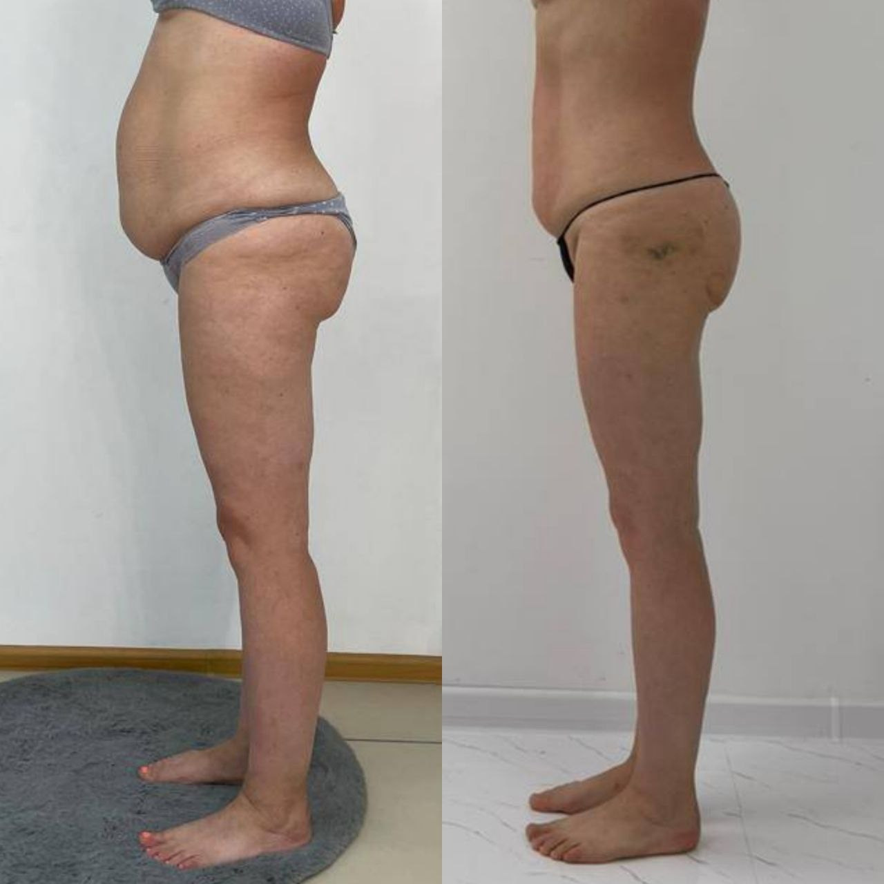 Результаты. Центр Коррекции Тела в городе Чехов