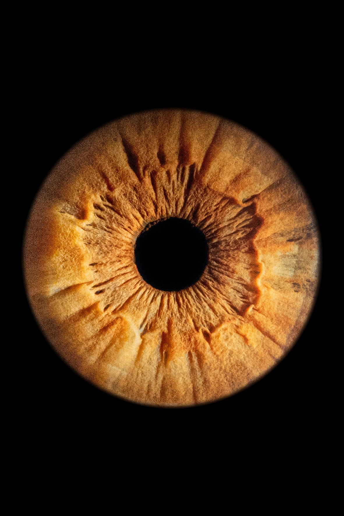 Примеры работ. Мой глаз