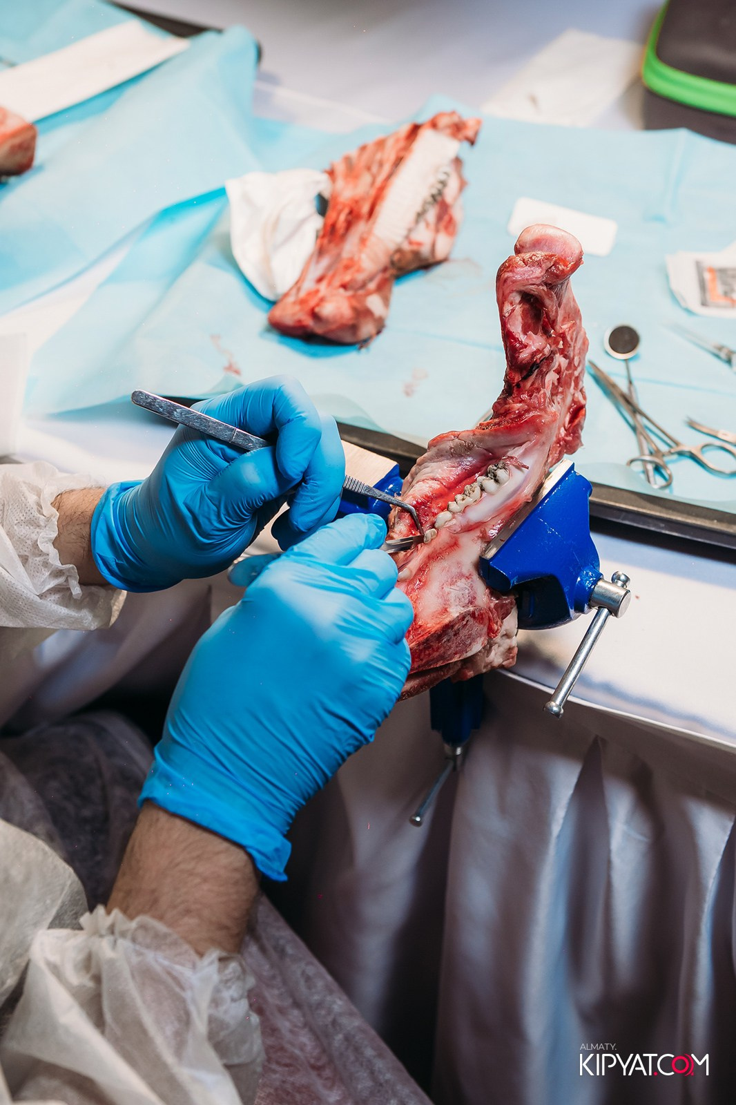 КУРС ДЛЯ СТОМАТОЛОГОВ ОСЛОЖНЕНИЯ В ХИРУРГИЧЕСКОЙ ПРАКТИКЕ КТО ВИНОВАТ И ЧТО ДЕЛАТЬ. КИПЯТКОМ АЛМАТЫ!