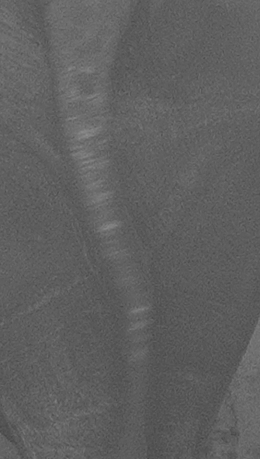 ПРЕГОЛЯ НЕ РЕКА. Художественная группа «Нежные Бабы»