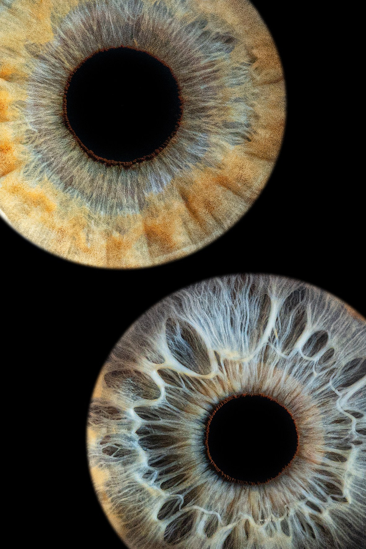 Примеры работ. Мой глаз