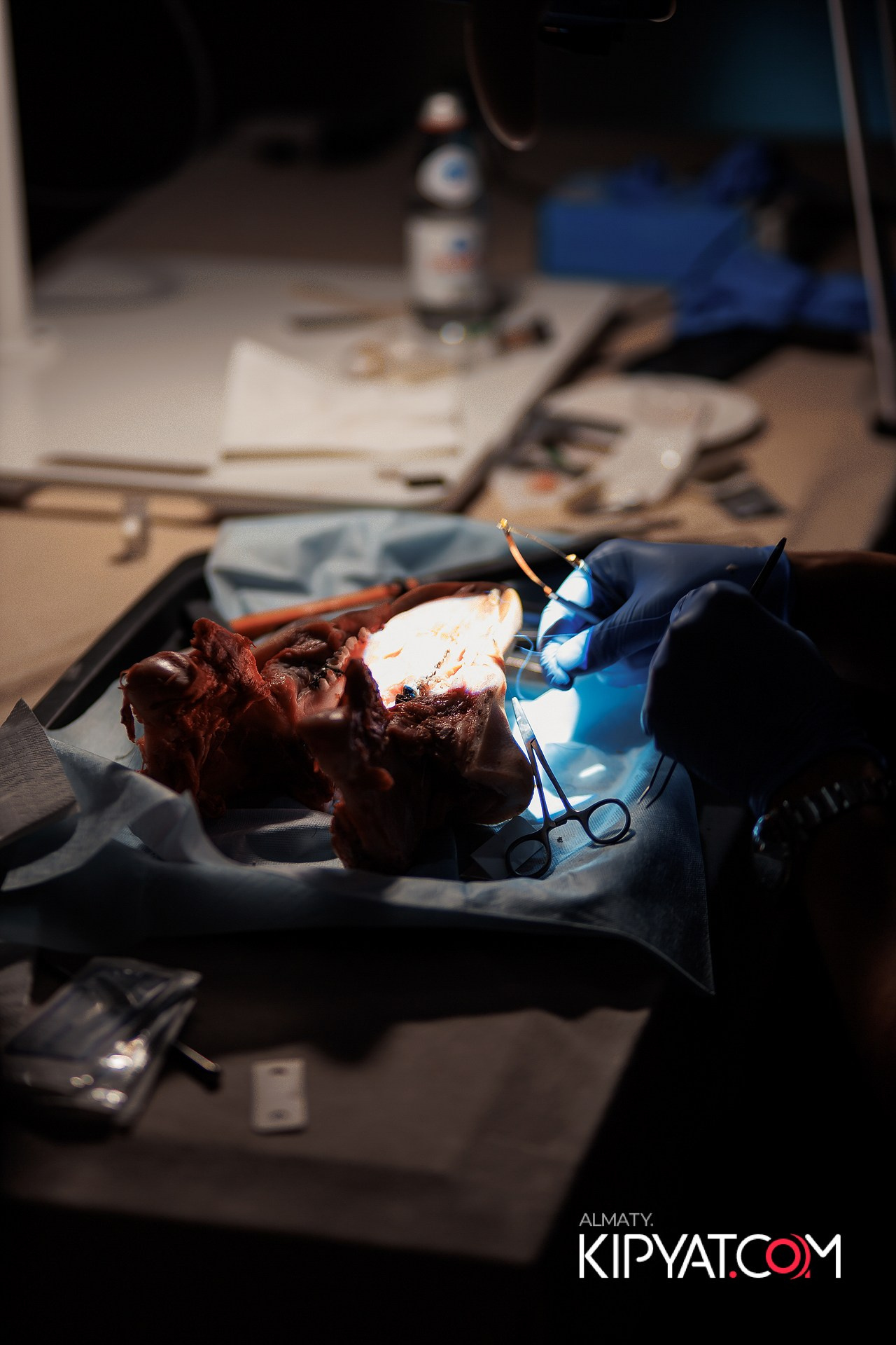 КУРС СТОМАТОЛОГОВ «НКР И ПОСЛЕДУЮЩАЯ РАБОТА С МЯГКИМИ ТКАНЯМИ». КИПЯТКОМ АЛМАТЫ!