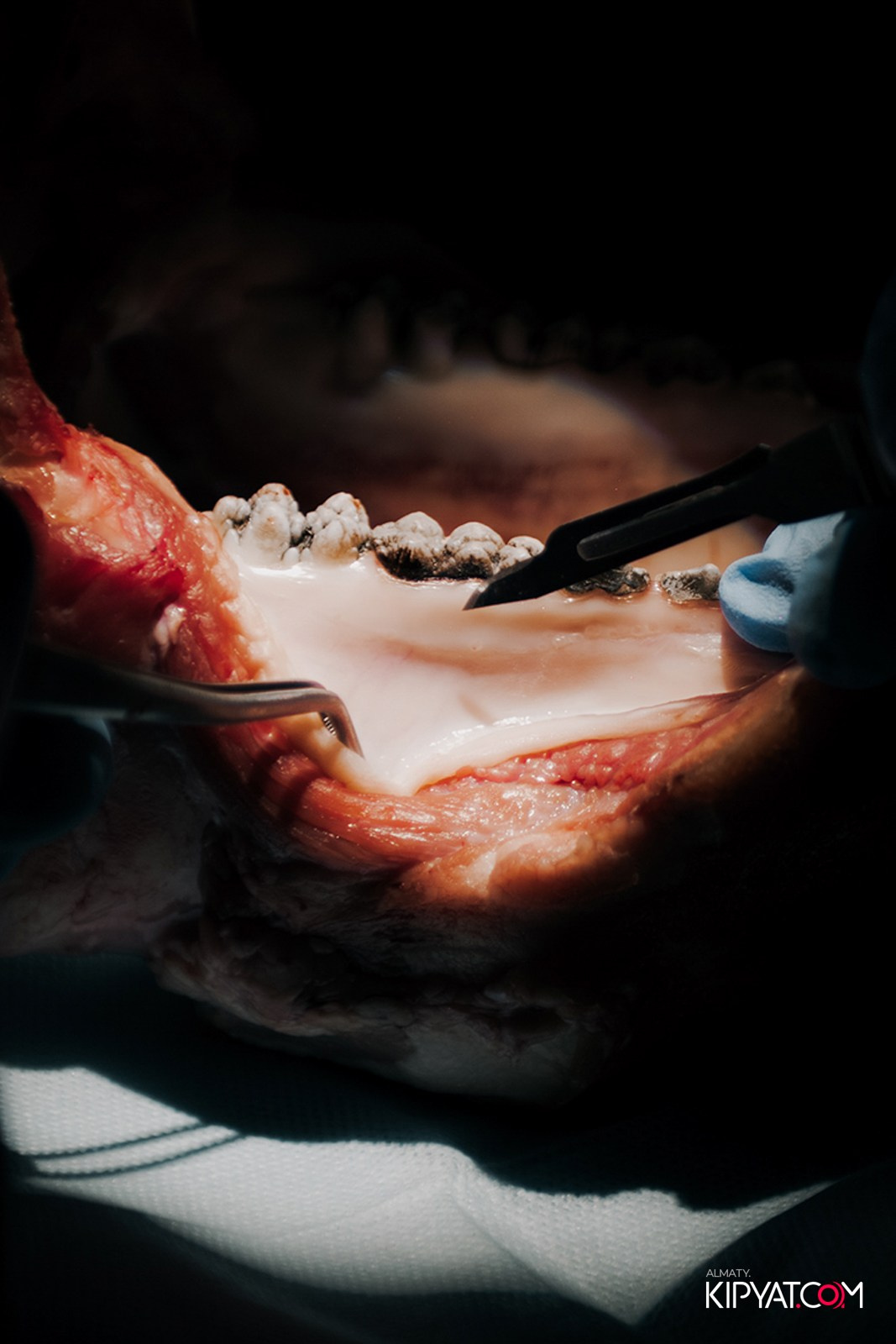 КУРС ДЛЯ СТОМАТОЛОГОВ ОСЛОЖНЕНИЯ В ХИРУРГИЧЕСКОЙ ПРАКТИКЕ КТО ВИНОВАТ И ЧТО ДЕЛАТЬ. КИПЯТКОМ АЛМАТЫ!