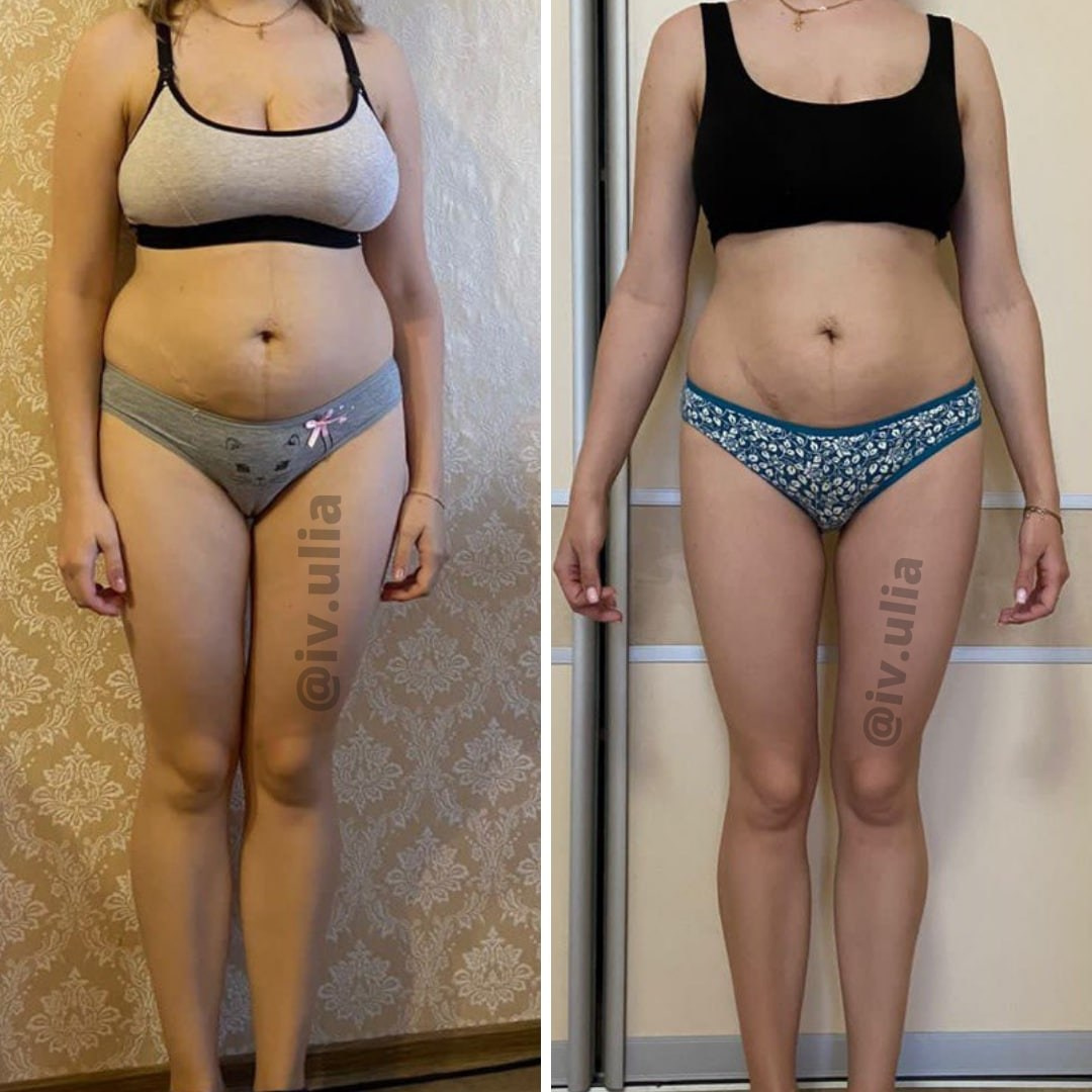 ДО/ПОСЛЕ. Нутрициолог Юлия Великова