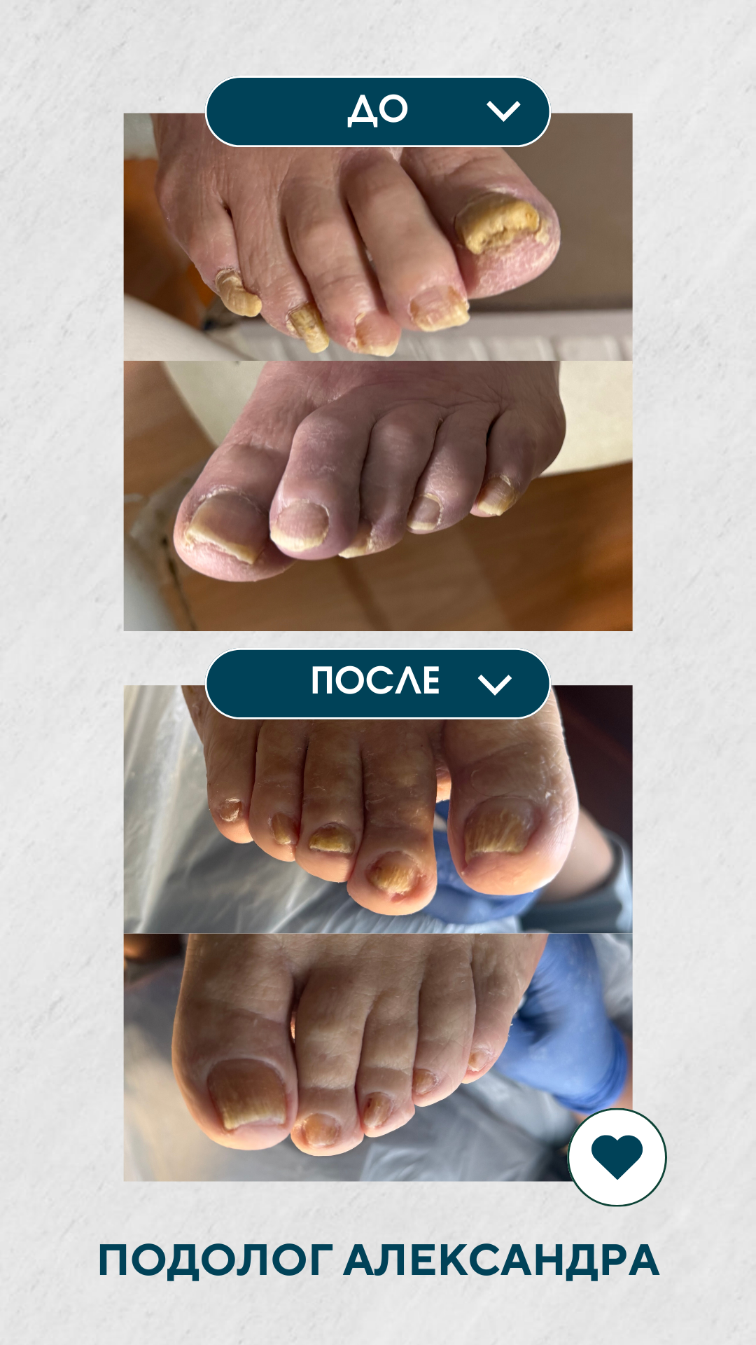 Благотворительный выезд в пансионат. Подолог г. Хабаровск — центр здоровой стопы «FOOTTIME»