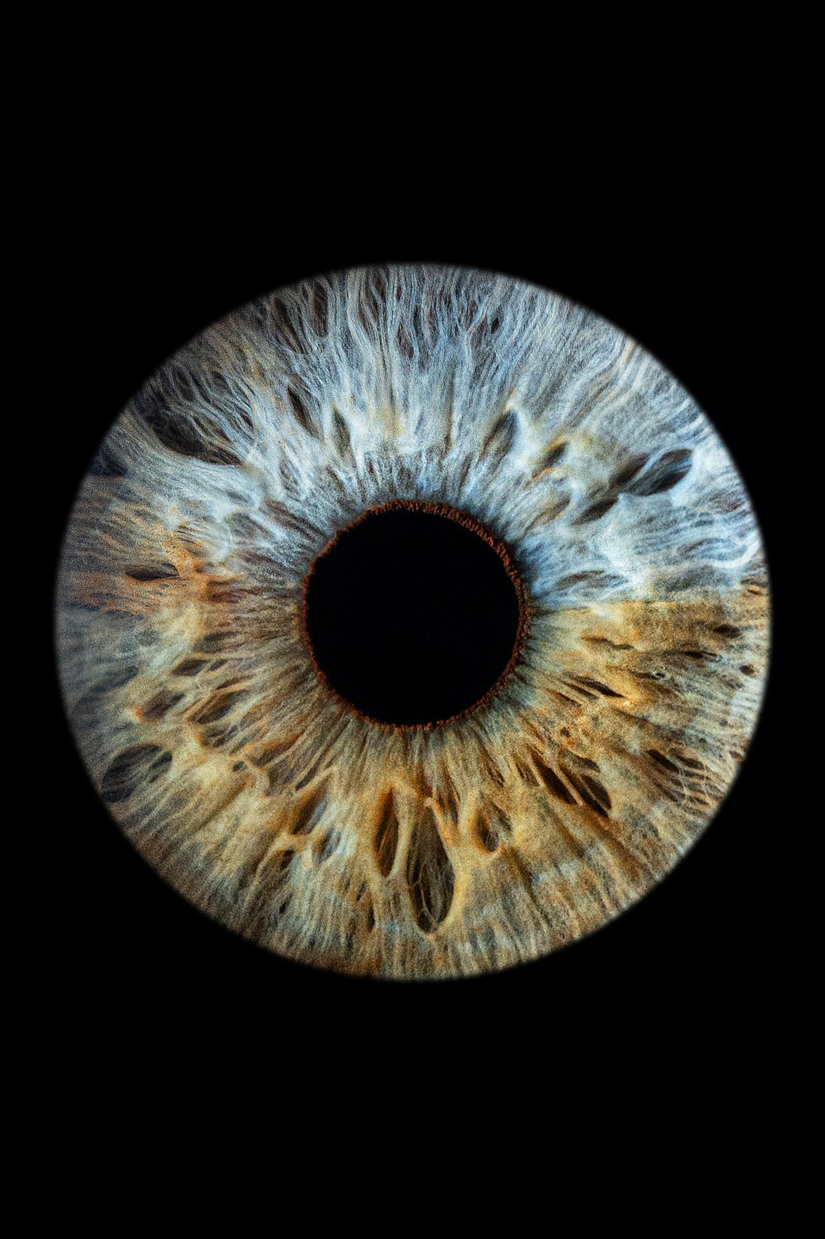 Примеры работ. Мой глаз