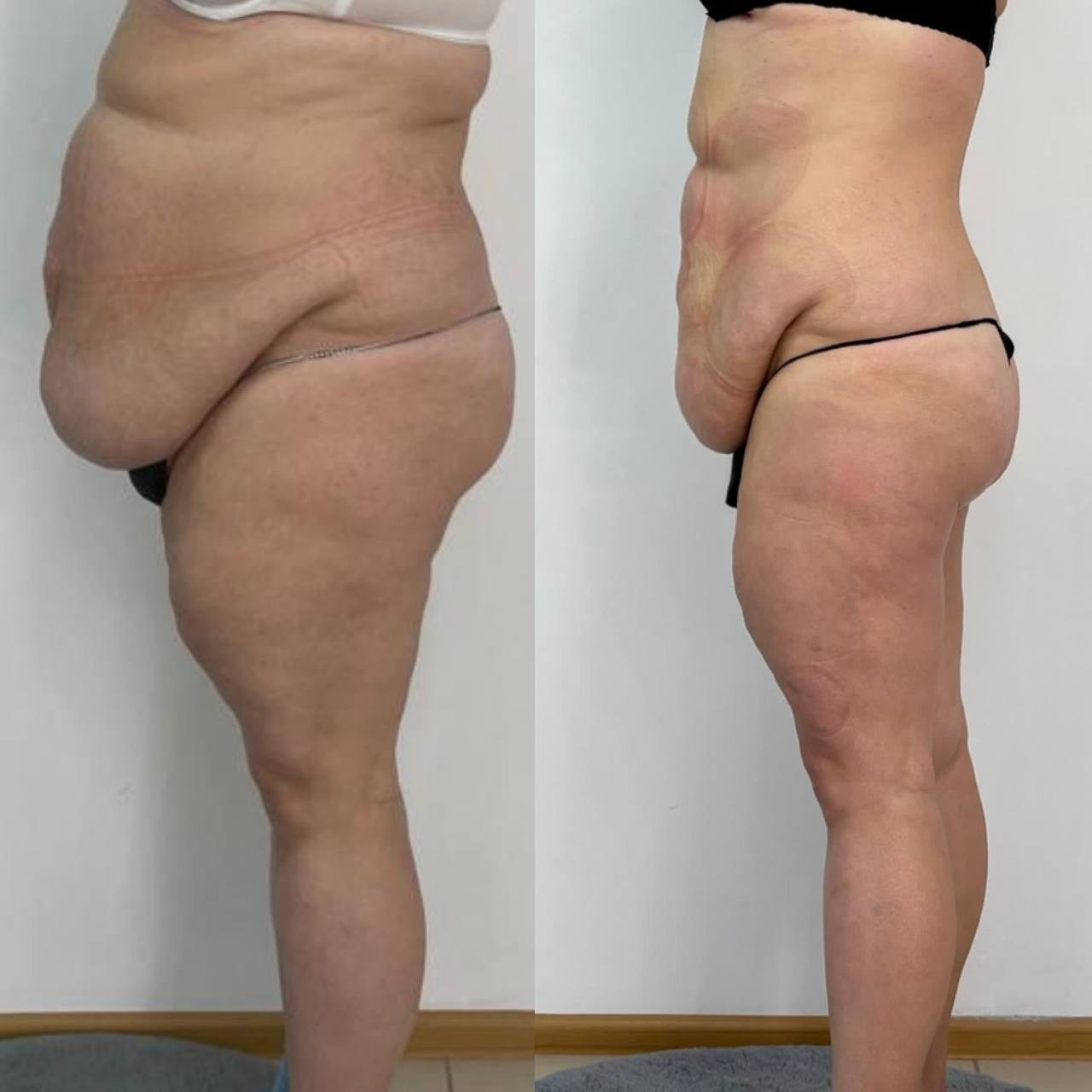 Результаты. Центр Коррекции Тела в городе Чехов