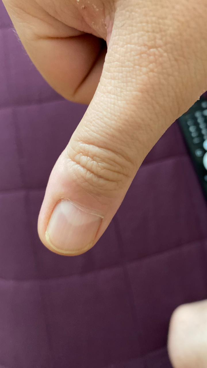 Самодеструкция. Подолог г. Хабаровск — центр здоровой стопы «FOOTTIME»