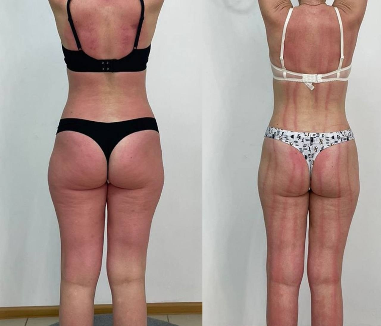 Результаты. Центр Коррекции Тела в городе Чехов