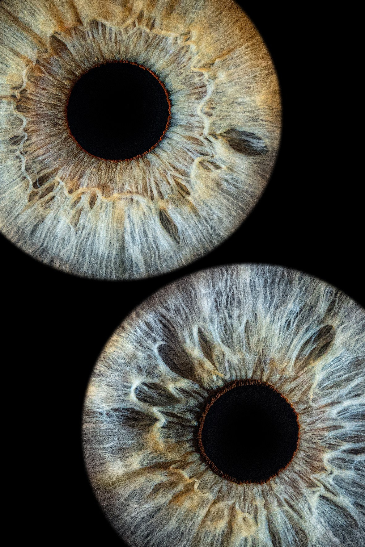 Примеры работ. Мой глаз