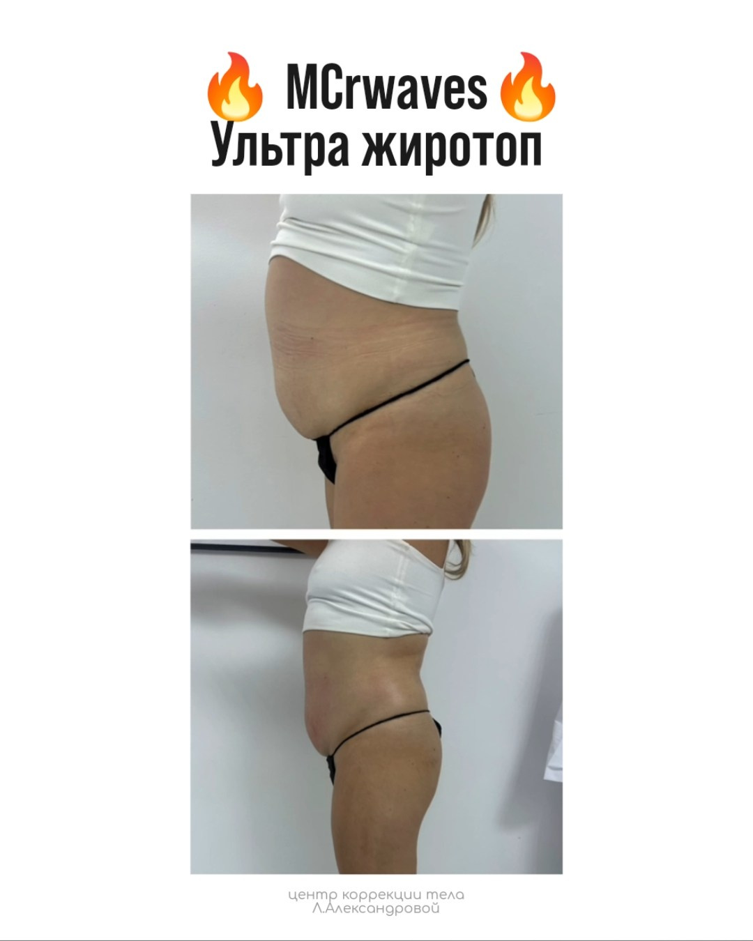 Результаты. Центр Коррекции Тела в городе Чехов