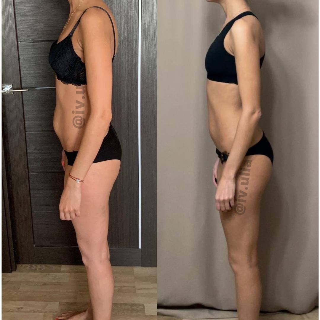 ДО/ПОСЛЕ. Нутрициолог Юлия Великова