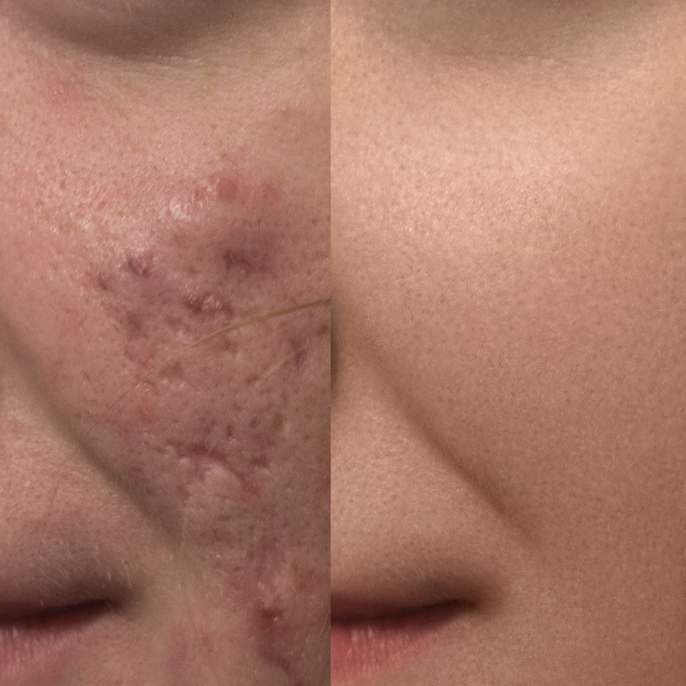 Бьюти ретушь и ретушь волос. Ретушер в Санкт-Петербурге Марина Дорогая