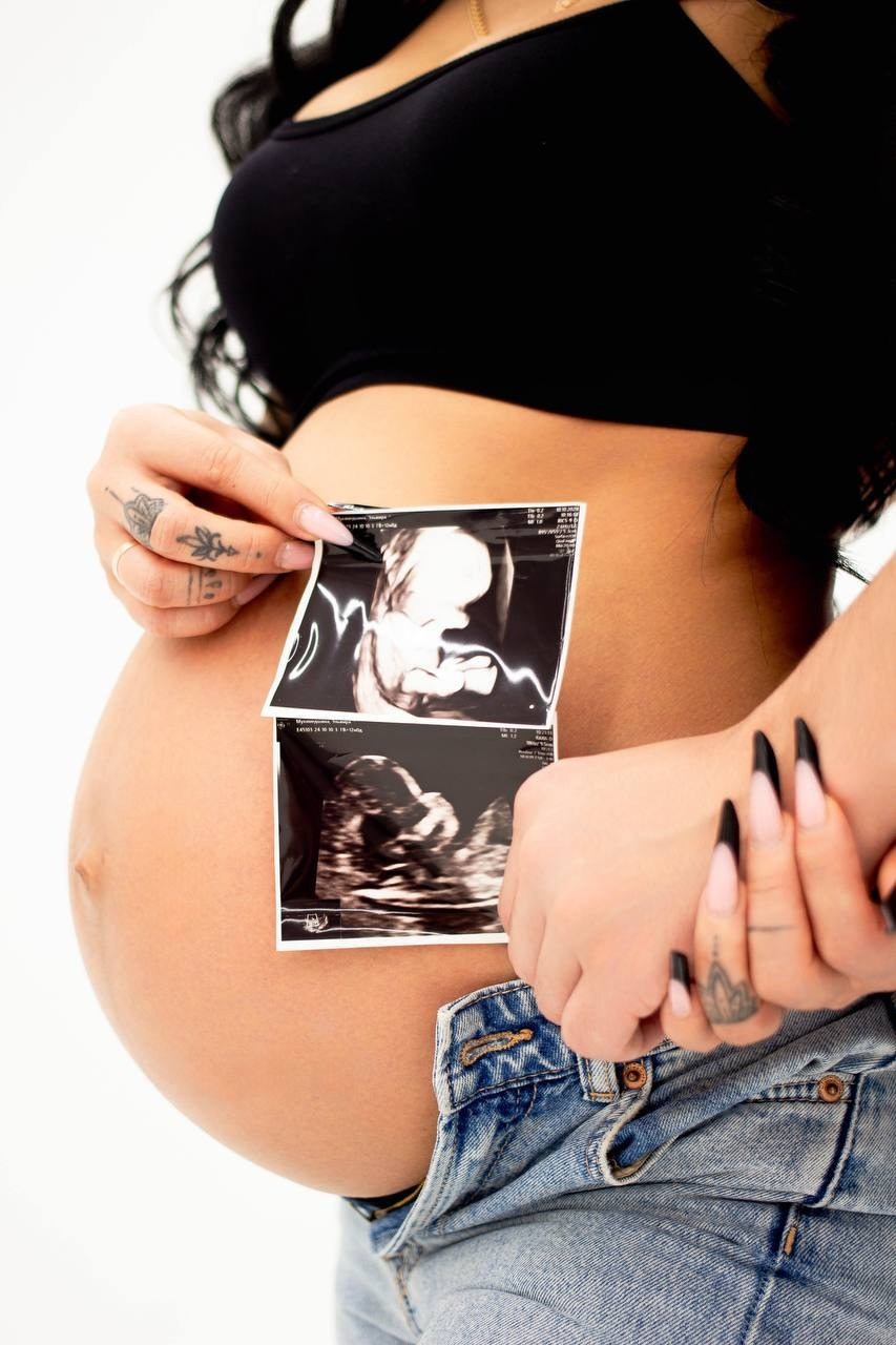 Love story. IM…PHOTO