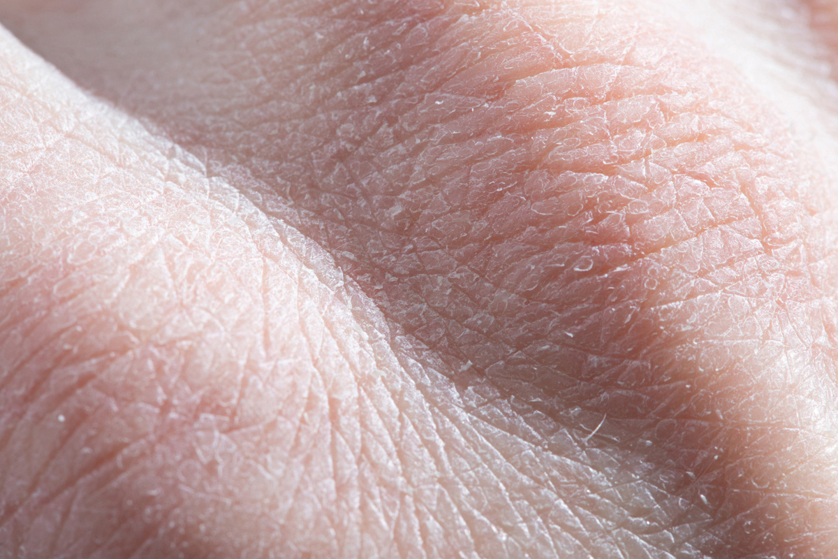 — Epidermics. Lena Ovchinnikova