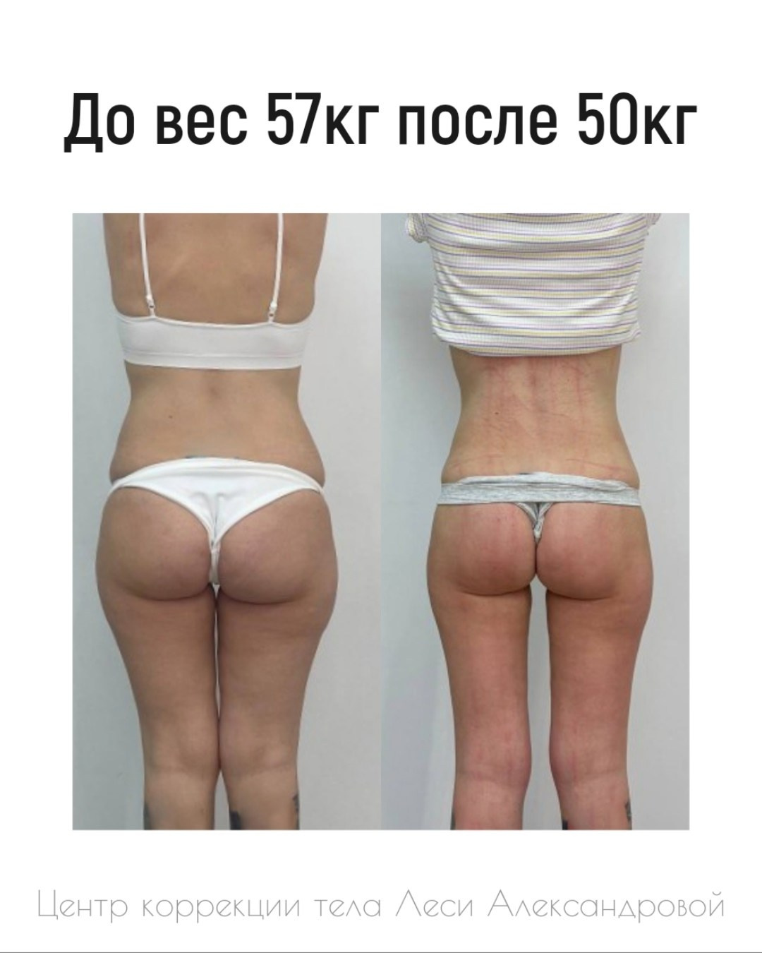 Результаты. Центр Коррекции Тела в городе Чехов