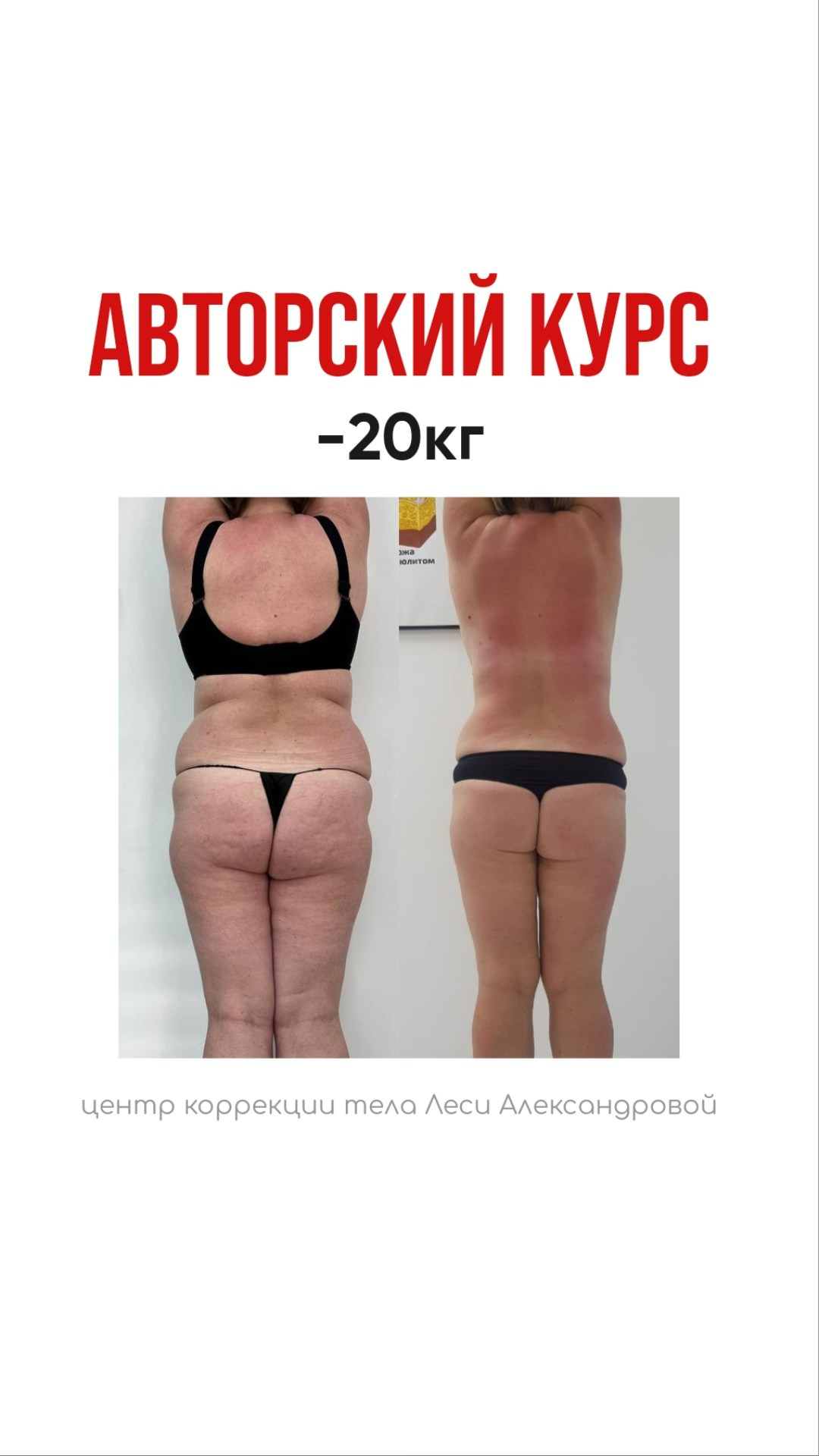 Результаты. Центр Коррекции Тела в городе Чехов