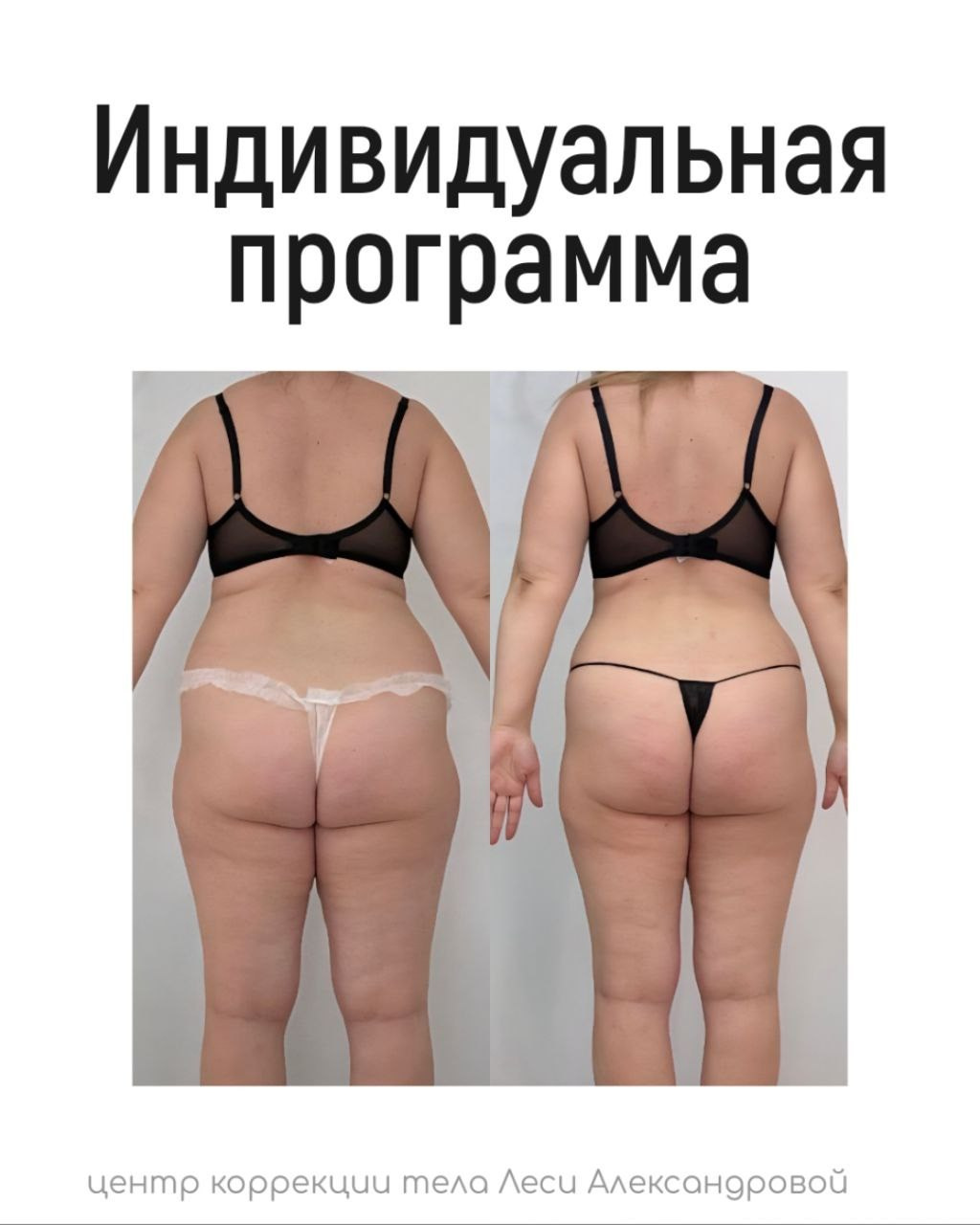 Результаты. Центр Коррекции Тела в городе Чехов