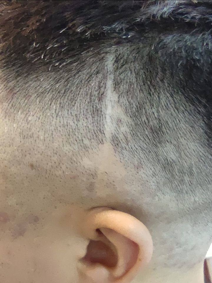 Нажмите на фото что бы открыть. SMP Трихопигментация Воронеж Волгоград Москва Казань Никита Нестеров