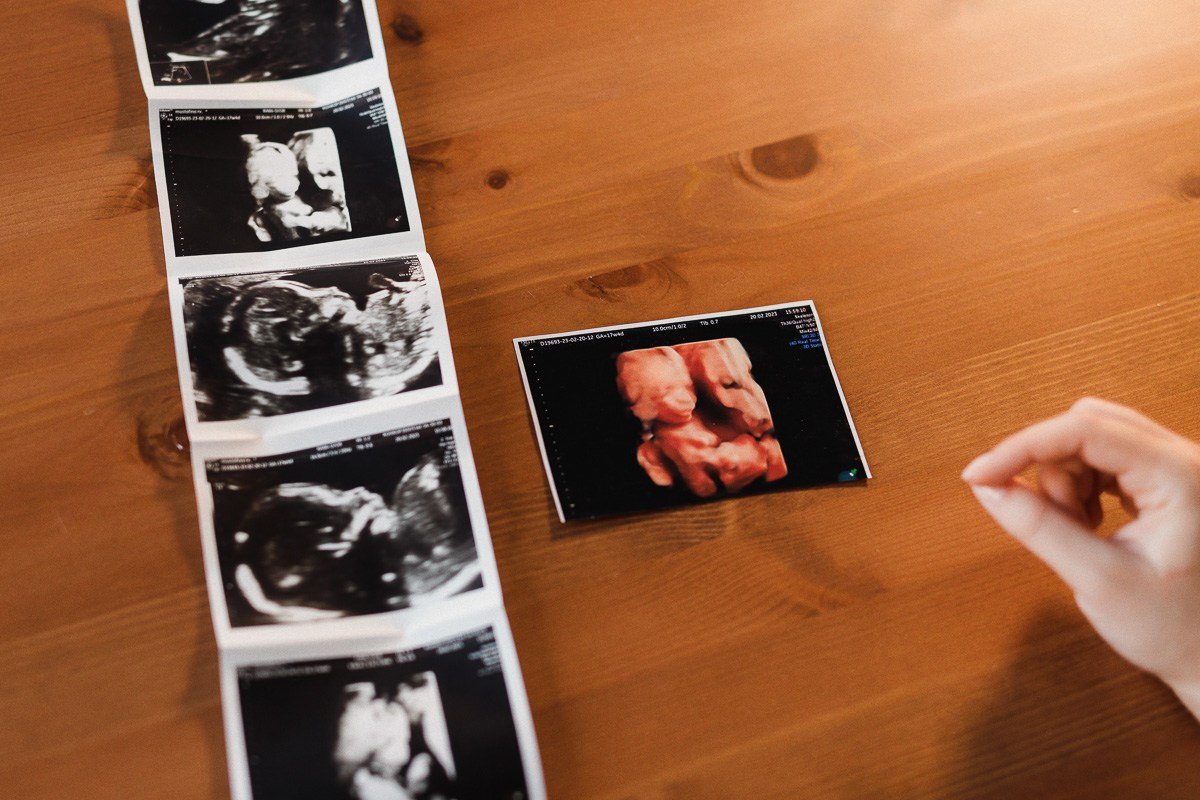 СЕМЬЯ. АЛЕКСАНДР ФОКС