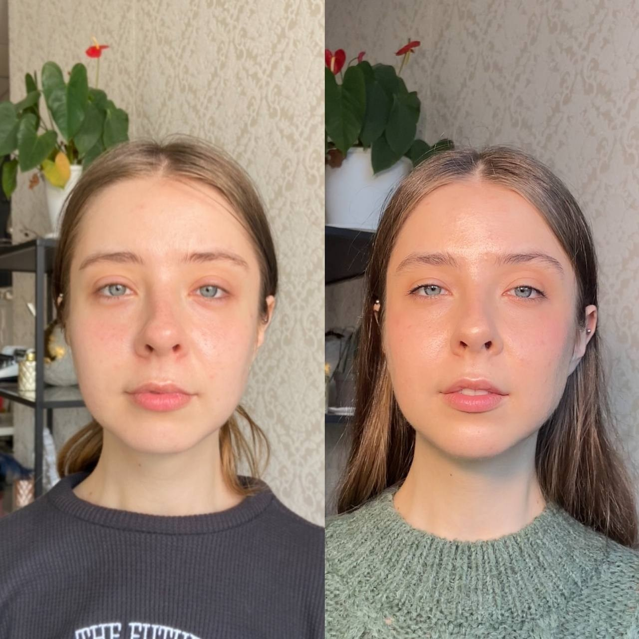 Процедура лифтинга овала лица массаж спб. Ботокс Fullface спб