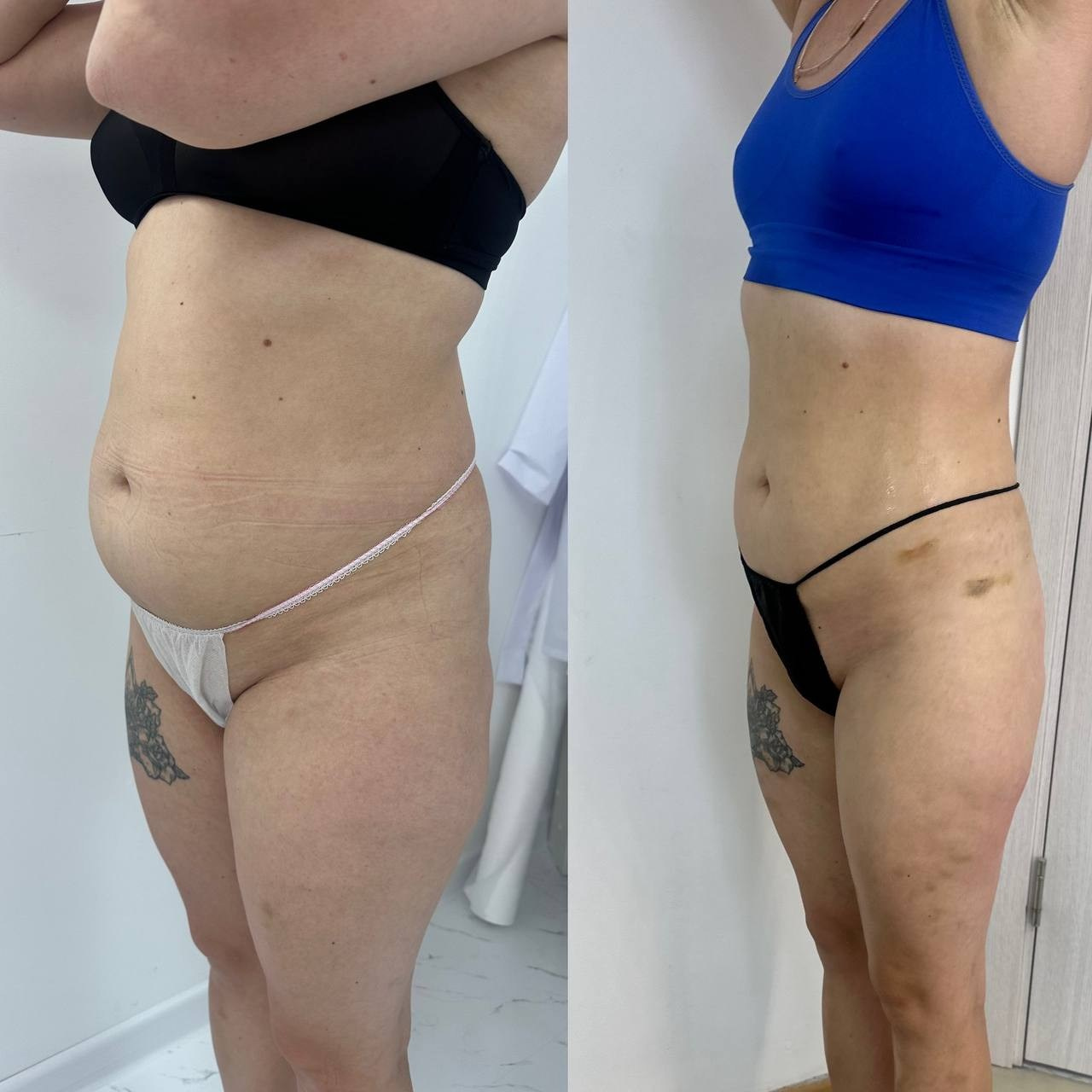 Результаты. Центр Коррекции Тела в городе Чехов