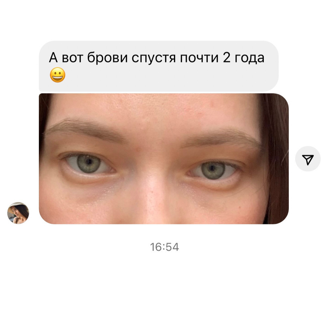 что происходит с татужем через два года