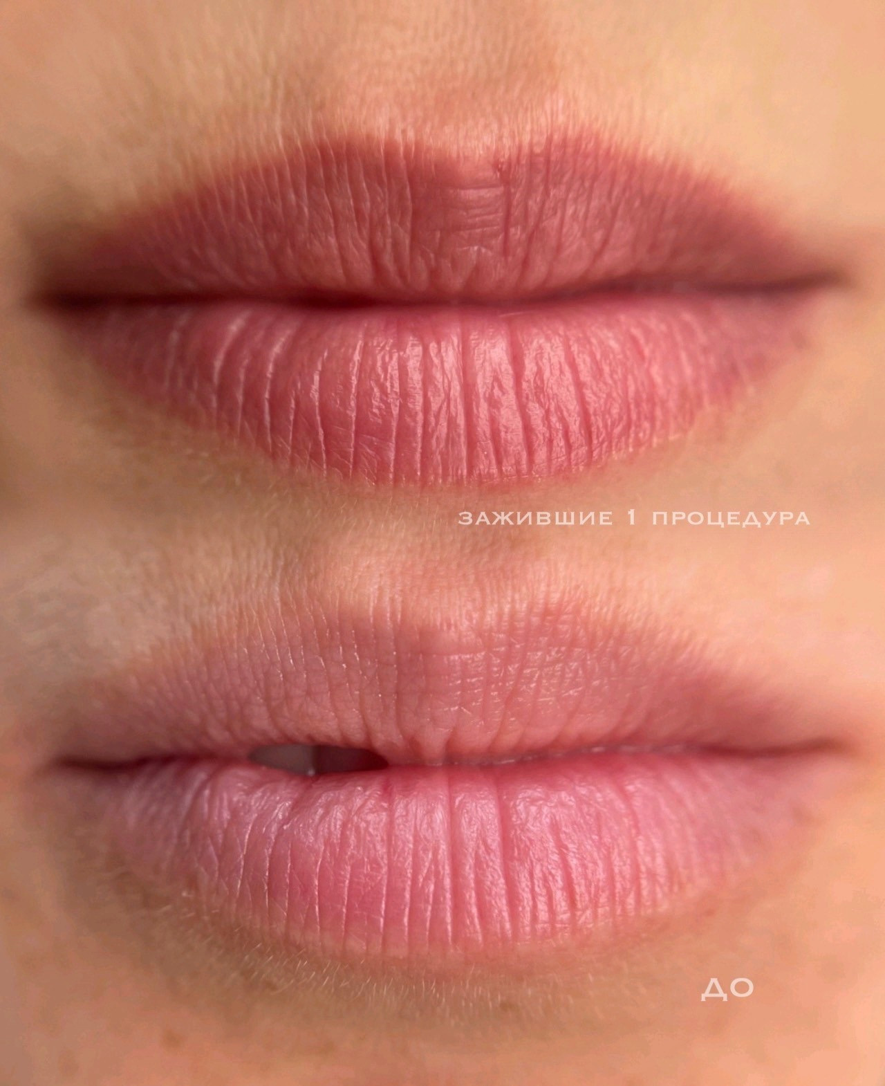 ГУБЫ зажившие. Перманентный макияж и удаление старого татуажа в Ростове-на-Дону Дарья Исакова