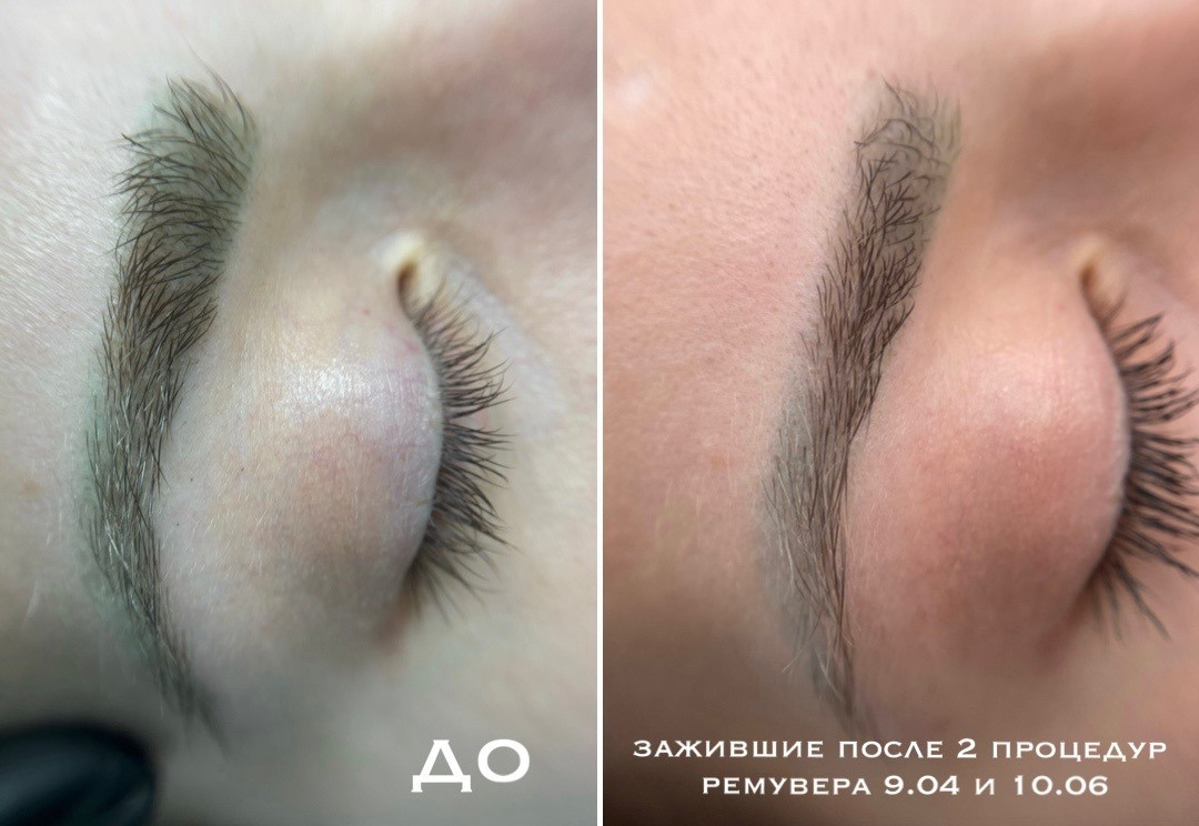 удаление зеленого оттенка бровей ремувером