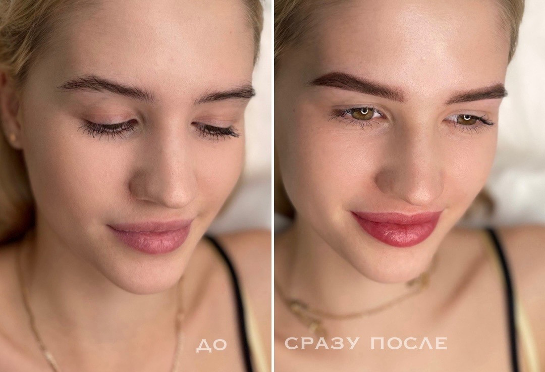 ГУБЫ сразу после процедуры. Перманентный макияж и удаление старого татуажа в Ростове-на-Дону Дарья Исакова