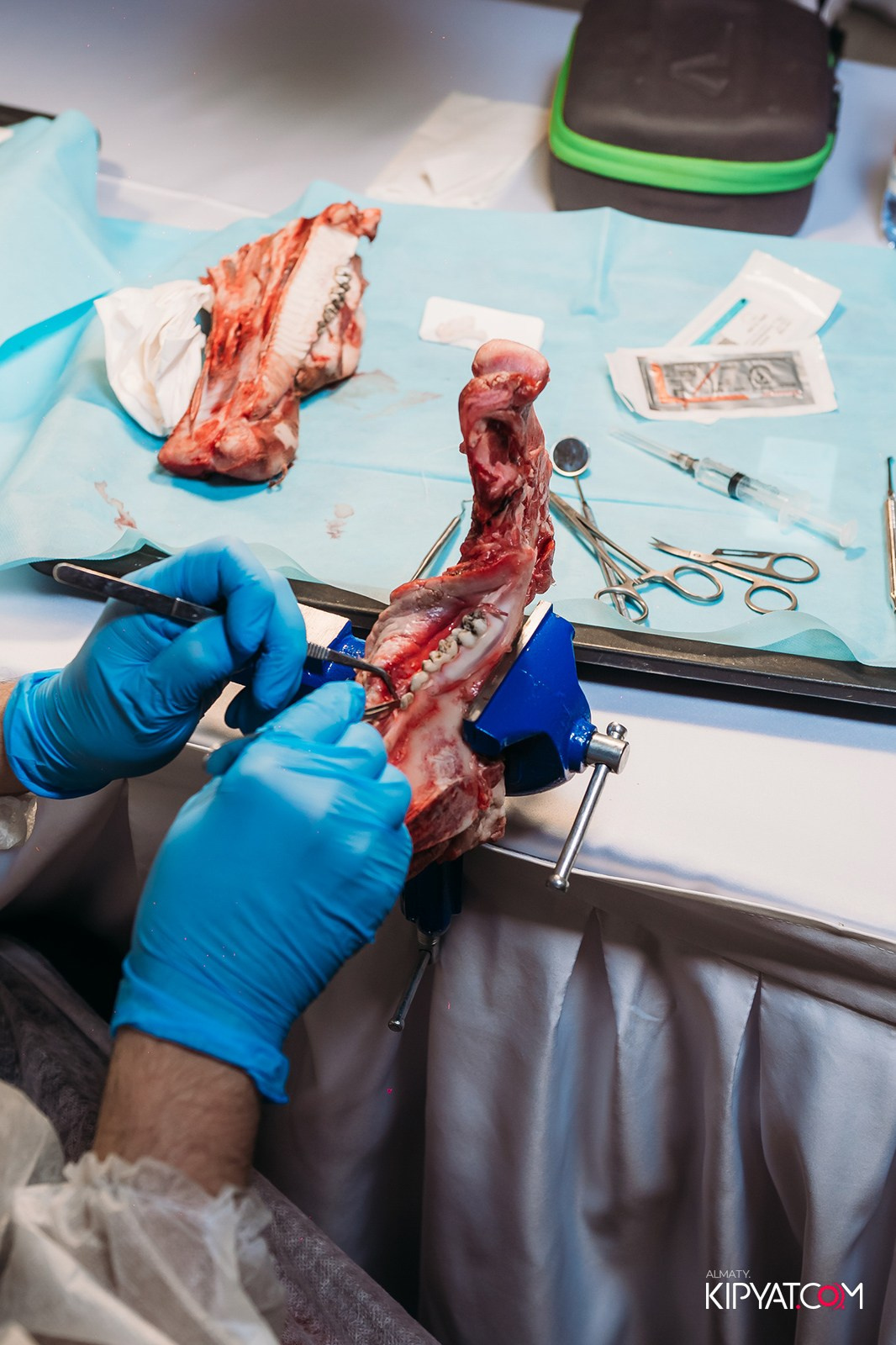 КУРС ДЛЯ СТОМАТОЛОГОВ ОСЛОЖНЕНИЯ В ХИРУРГИЧЕСКОЙ ПРАКТИКЕ КТО ВИНОВАТ И ЧТО ДЕЛАТЬ. КИПЯТКОМ АЛМАТЫ!