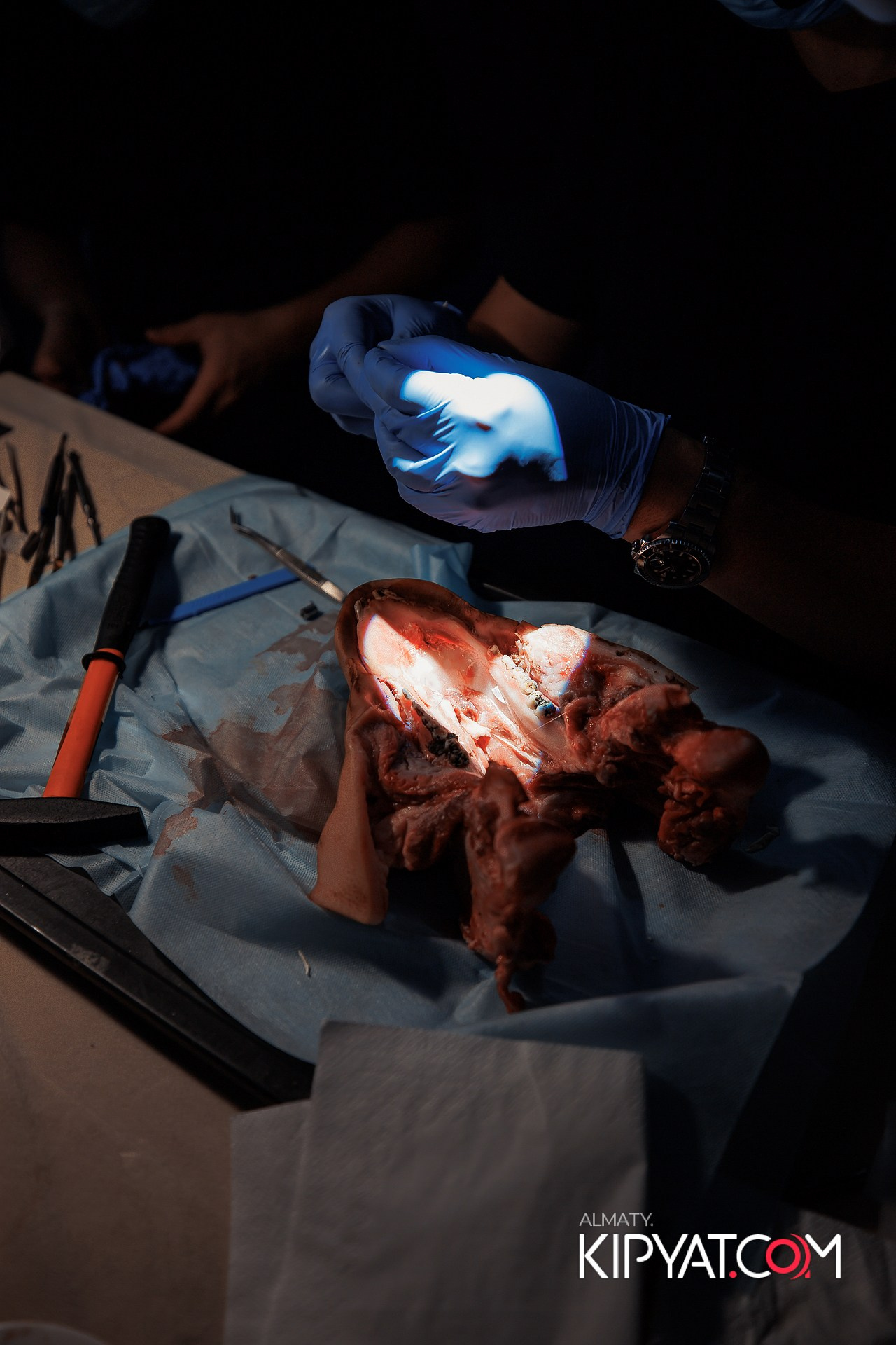 КУРС СТОМАТОЛОГОВ «НКР И ПОСЛЕДУЮЩАЯ РАБОТА С МЯГКИМИ ТКАНЯМИ». КИПЯТКОМ АЛМАТЫ!