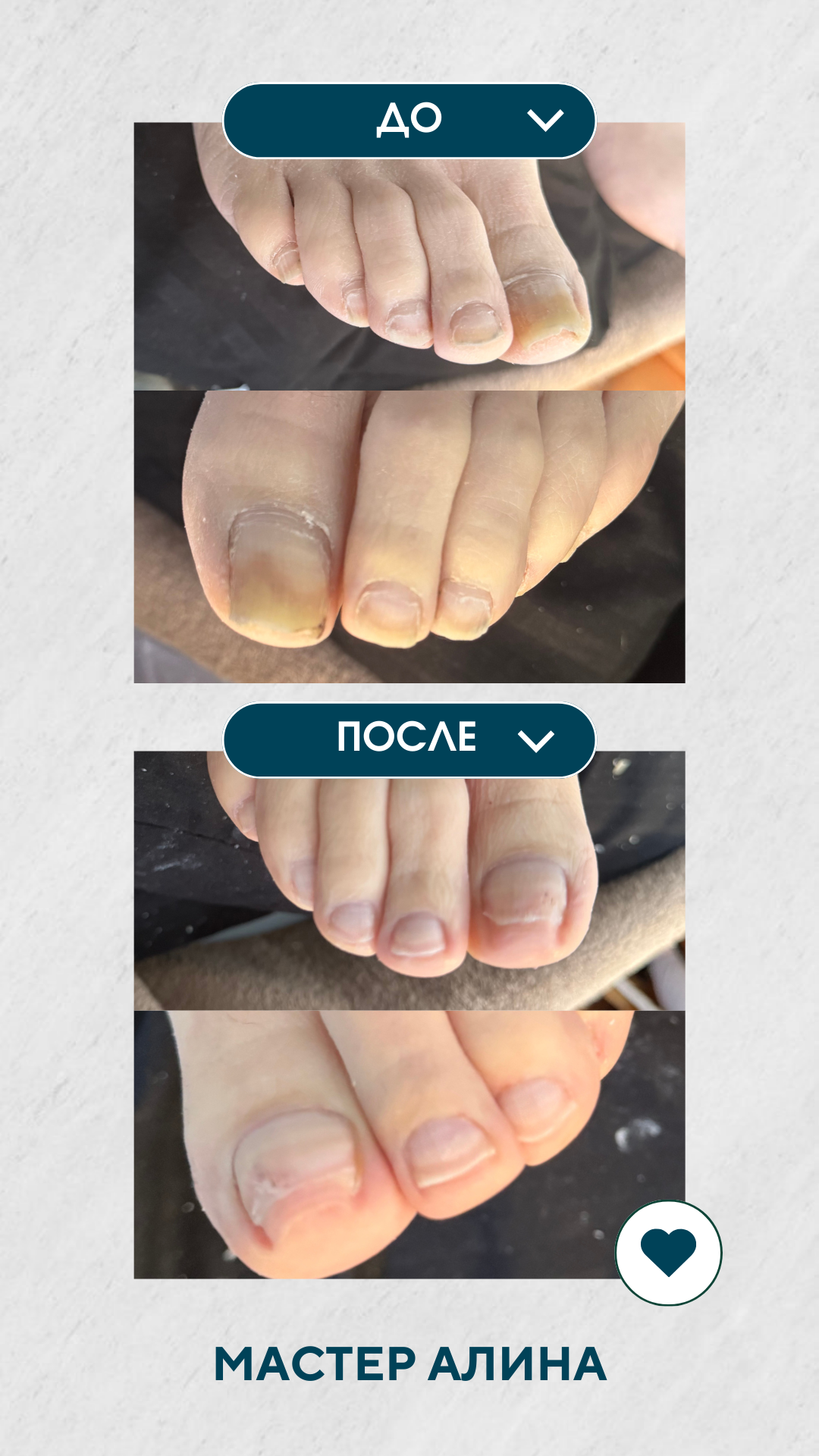 Благотворительный выезд в пансионат. Подолог г. Хабаровск — центр здоровой стопы «FOOTTIME»