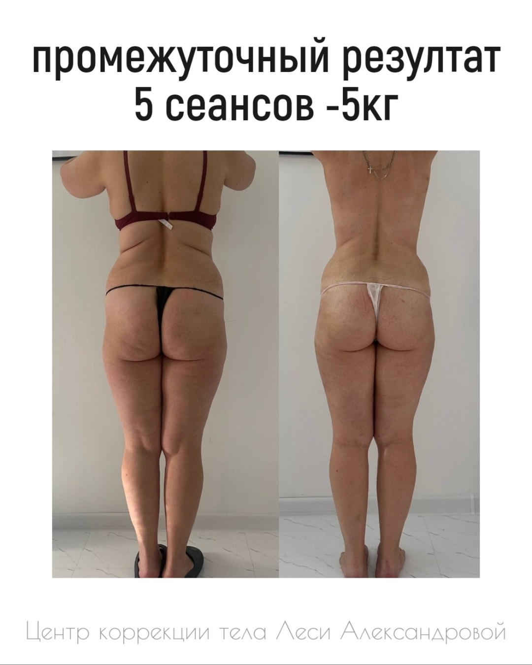 Результаты. Центр Коррекции Тела в городе Чехов