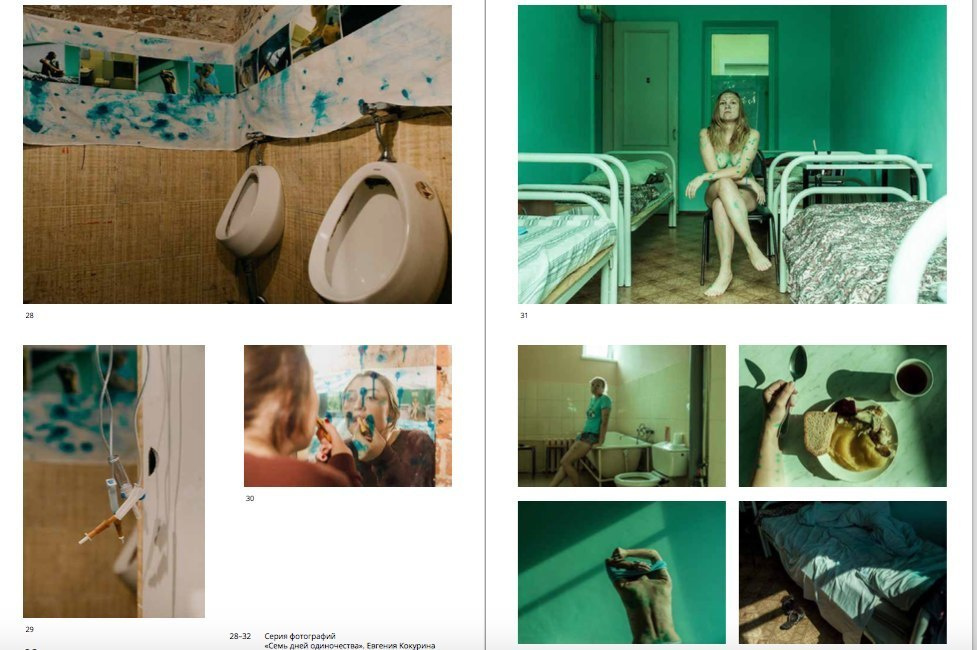 CHICKENPOX. Evgeniya Kokurina