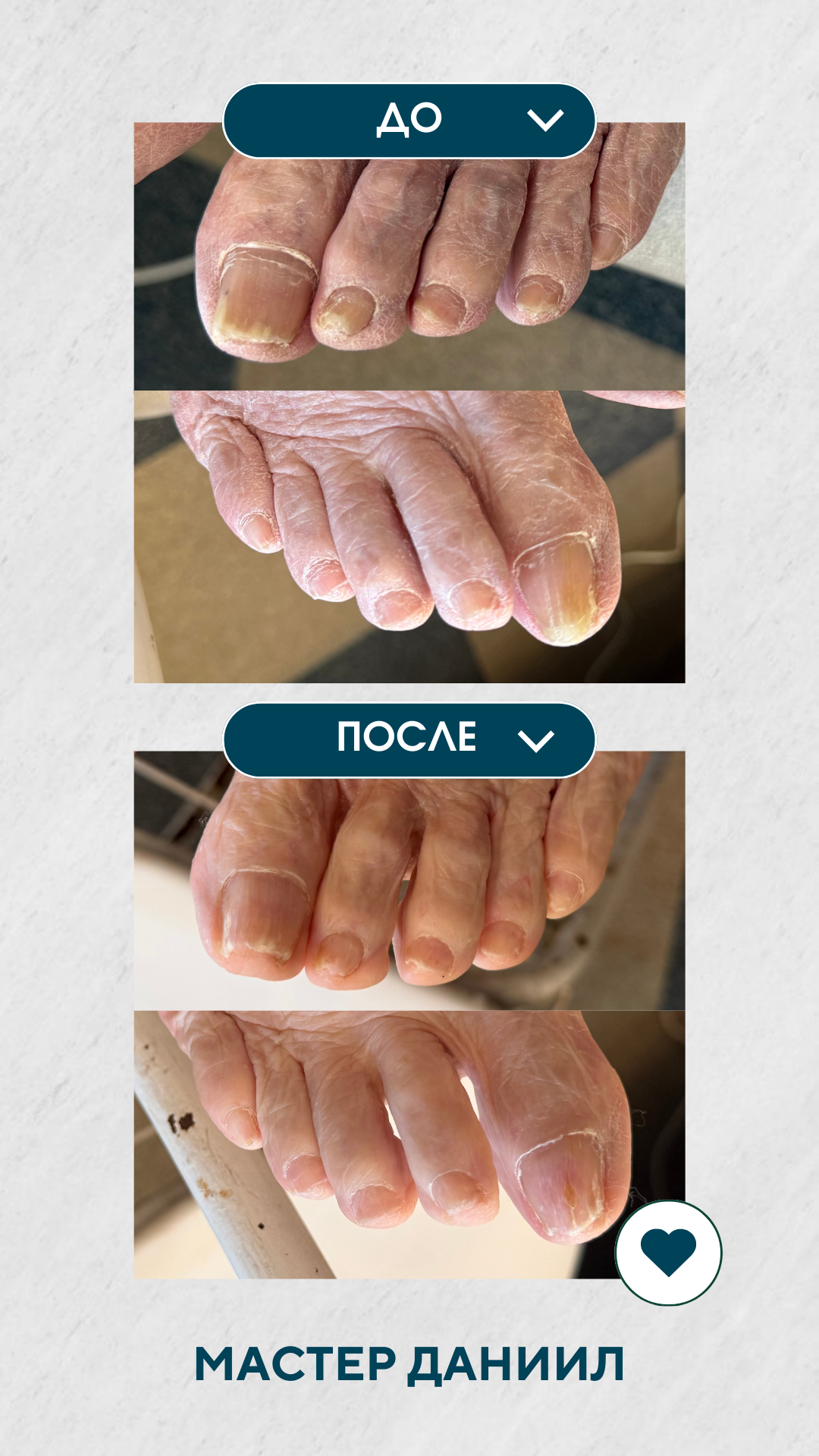 Благотворительный выезд в пансионат. Подолог г. Хабаровск — центр здоровой стопы «FOOTTIME»