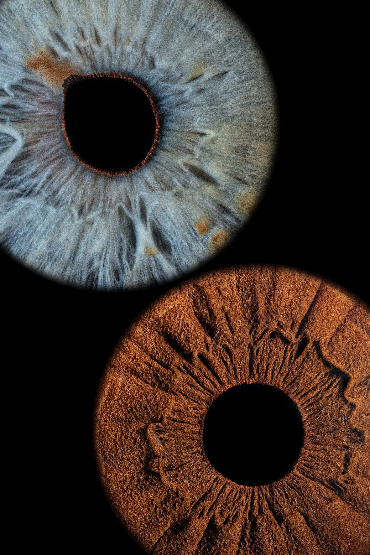 Примеры работ. Мой глаз