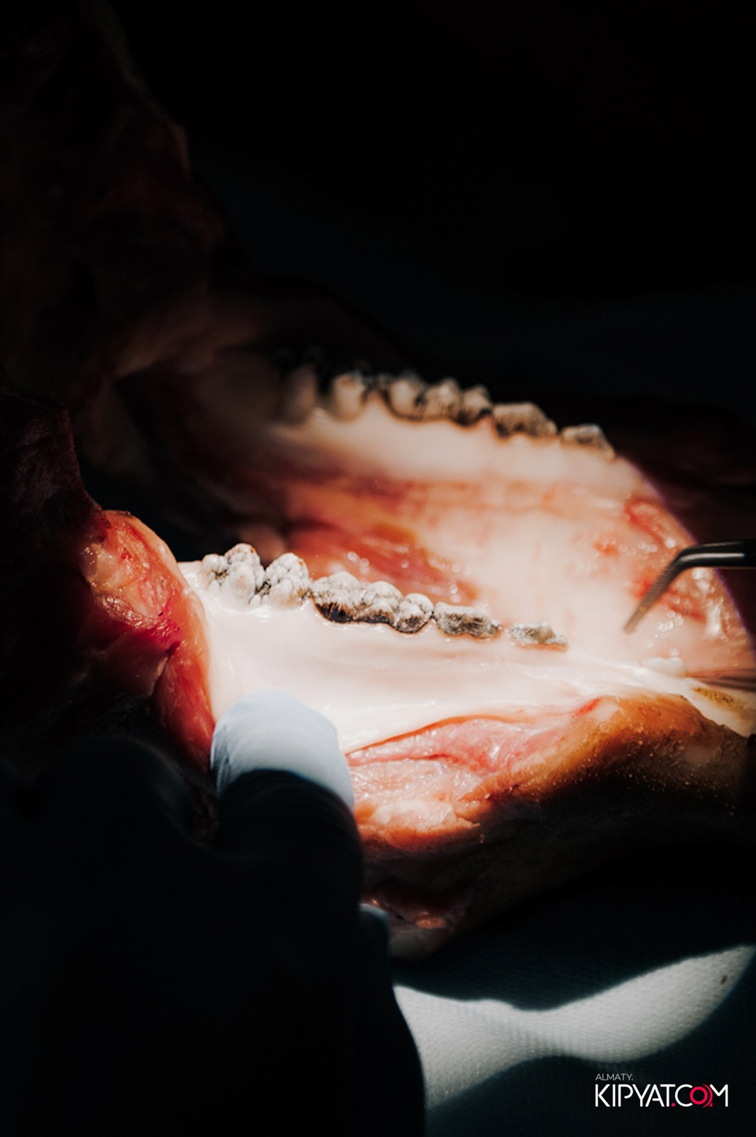 КУРС ДЛЯ СТОМАТОЛОГОВ ОСЛОЖНЕНИЯ В ХИРУРГИЧЕСКОЙ ПРАКТИКЕ КТО ВИНОВАТ И ЧТО ДЕЛАТЬ. КИПЯТКОМ АЛМАТЫ!