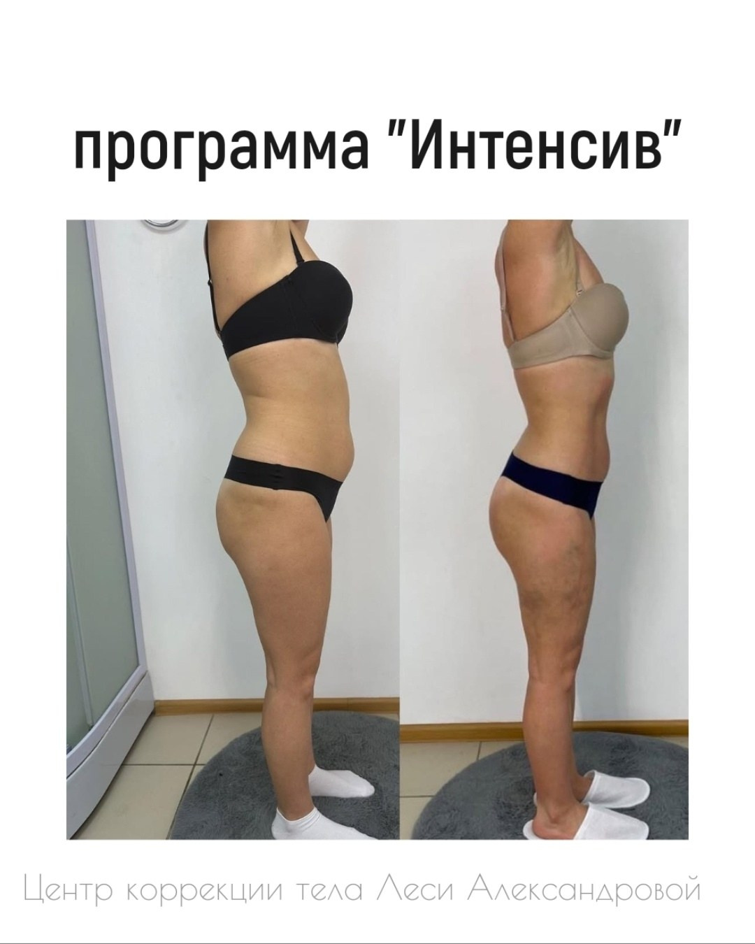 Результаты. Центр Коррекции Тела в городе Чехов