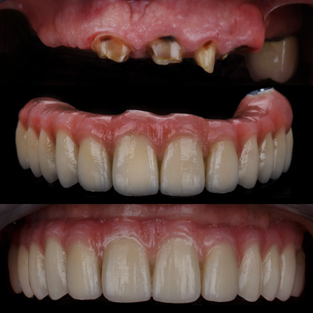 Ортопедия. Дентал фотограф — видеограф Денис Дорошенко