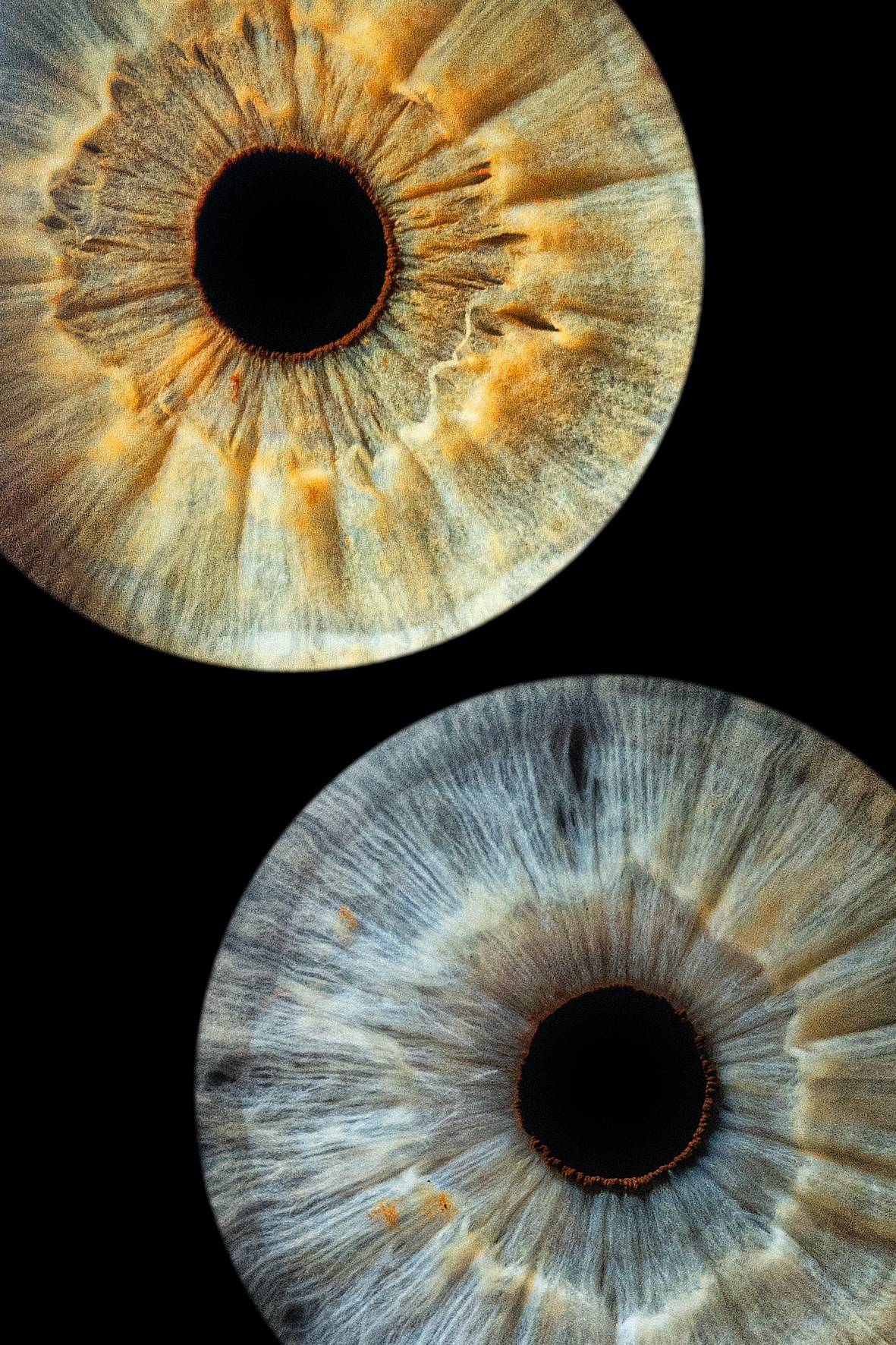 фотография радужки глаза Хабаровск фото радужки глаза Хабаровск